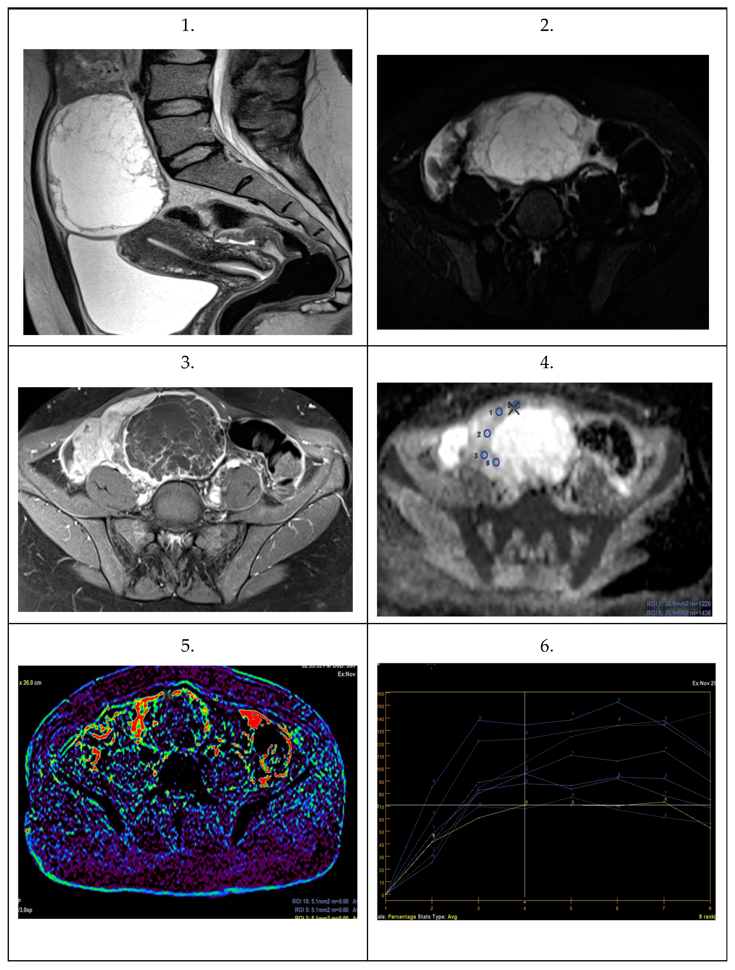 Cancers 16 03569 g019