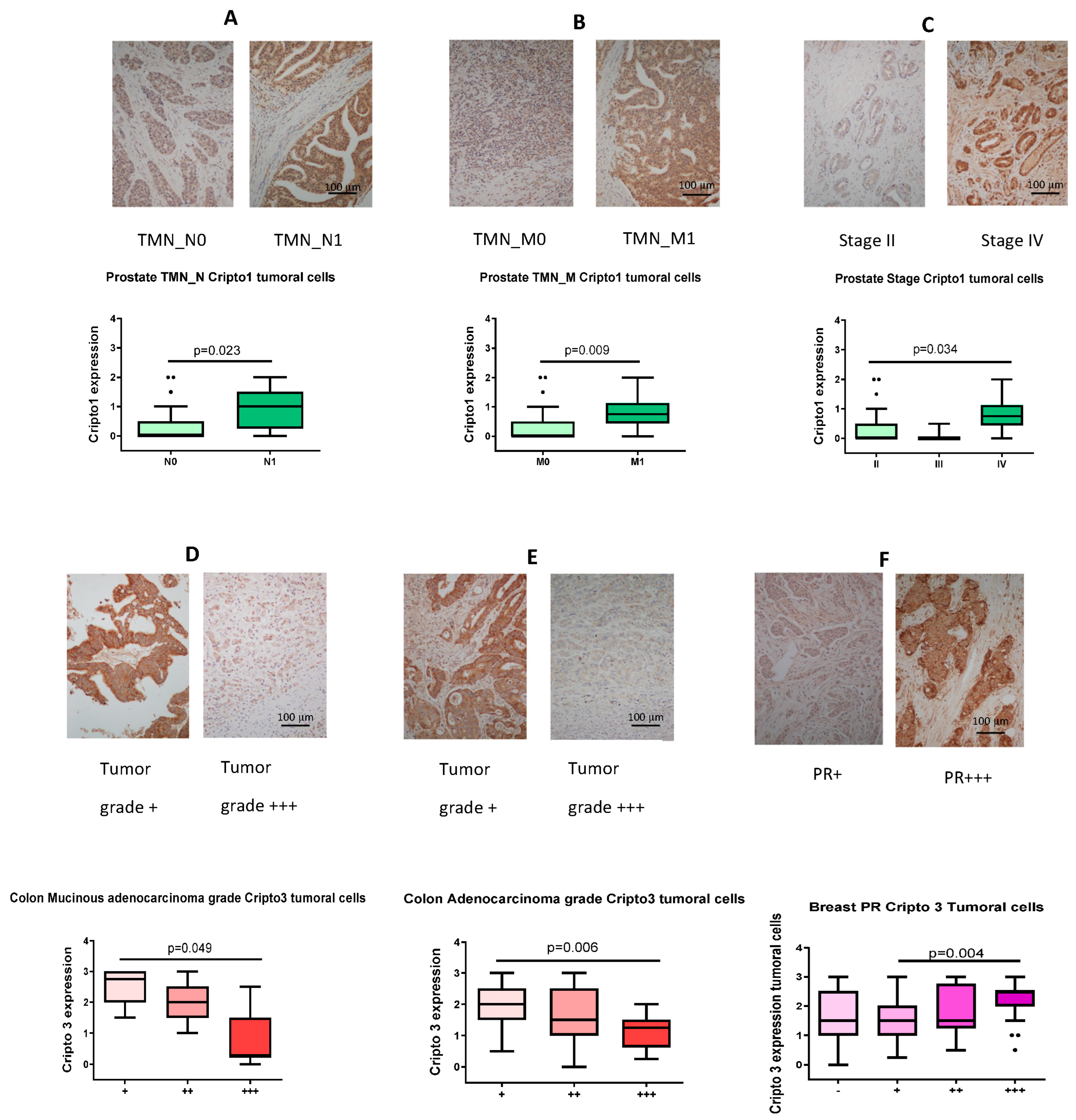 Cancers 16 03577 g005 Cancers 16 03577 g005