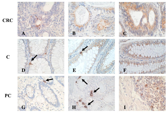 TONELLI アートブック Differentially Expressed Somatostatin (SST) and Its