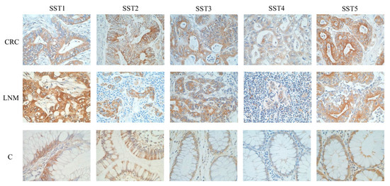 TONELLI アートブック Differentially Expressed Somatostatin (SST) and Its