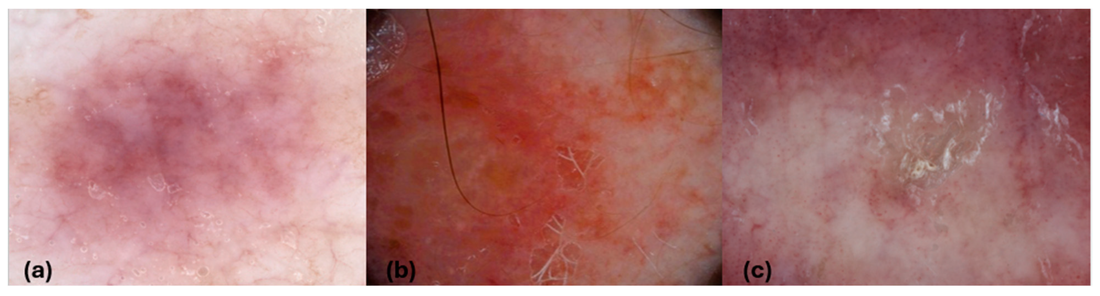 Cancers 16 03608 g001