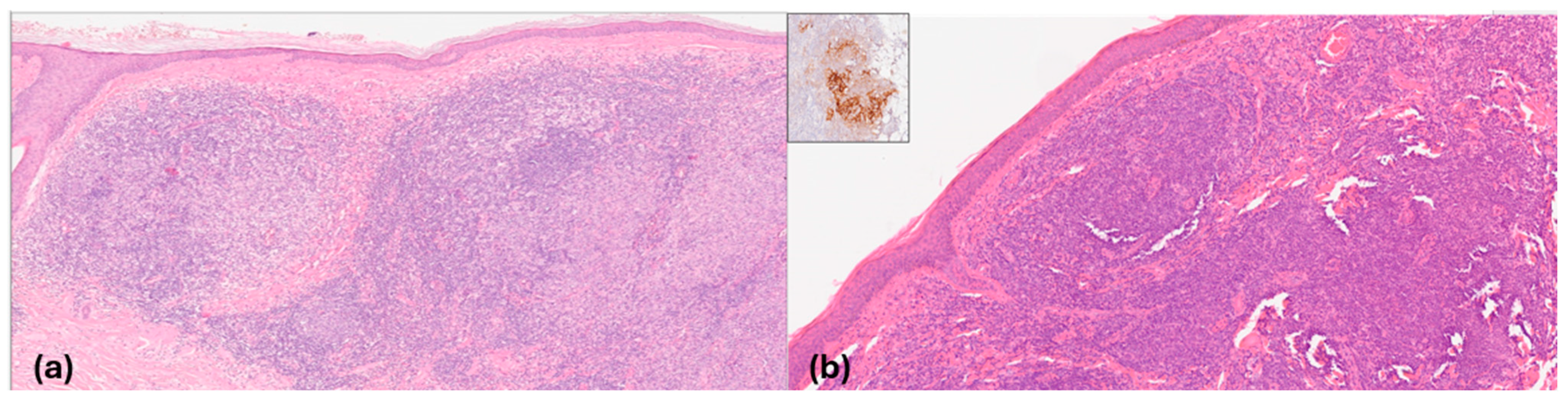 Cancers 16 03608 g010