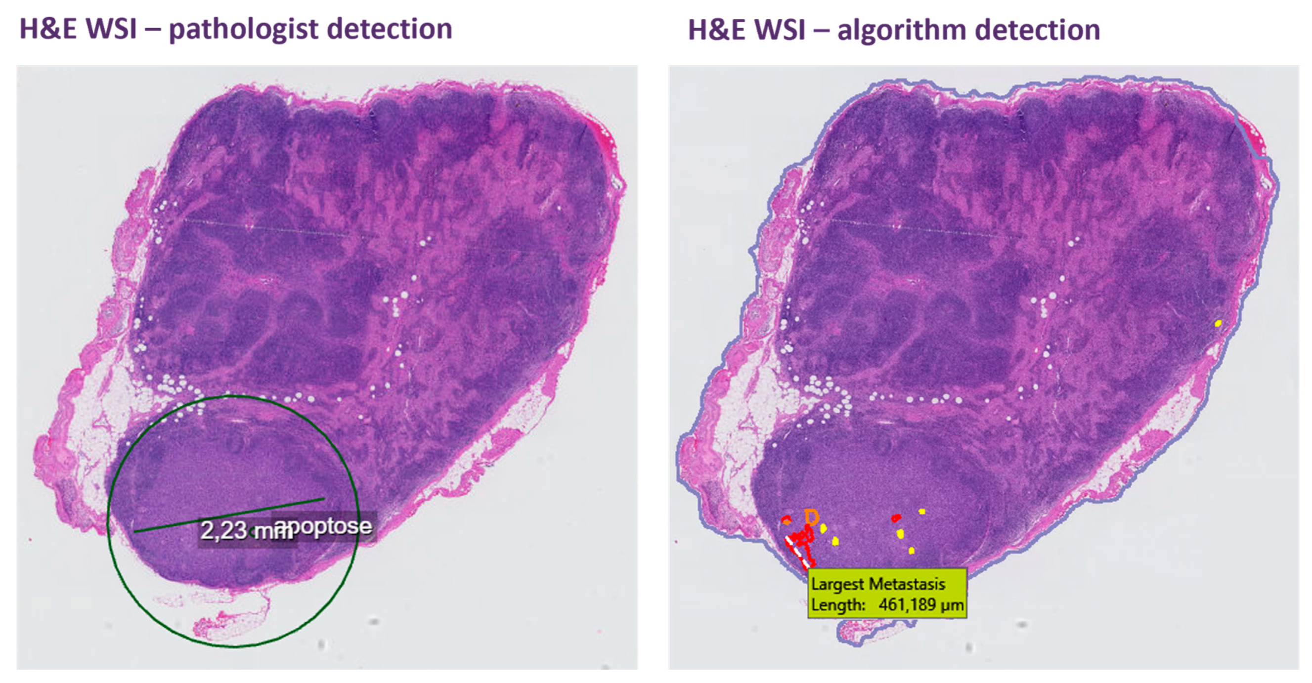 Cancers 16 03619 g002