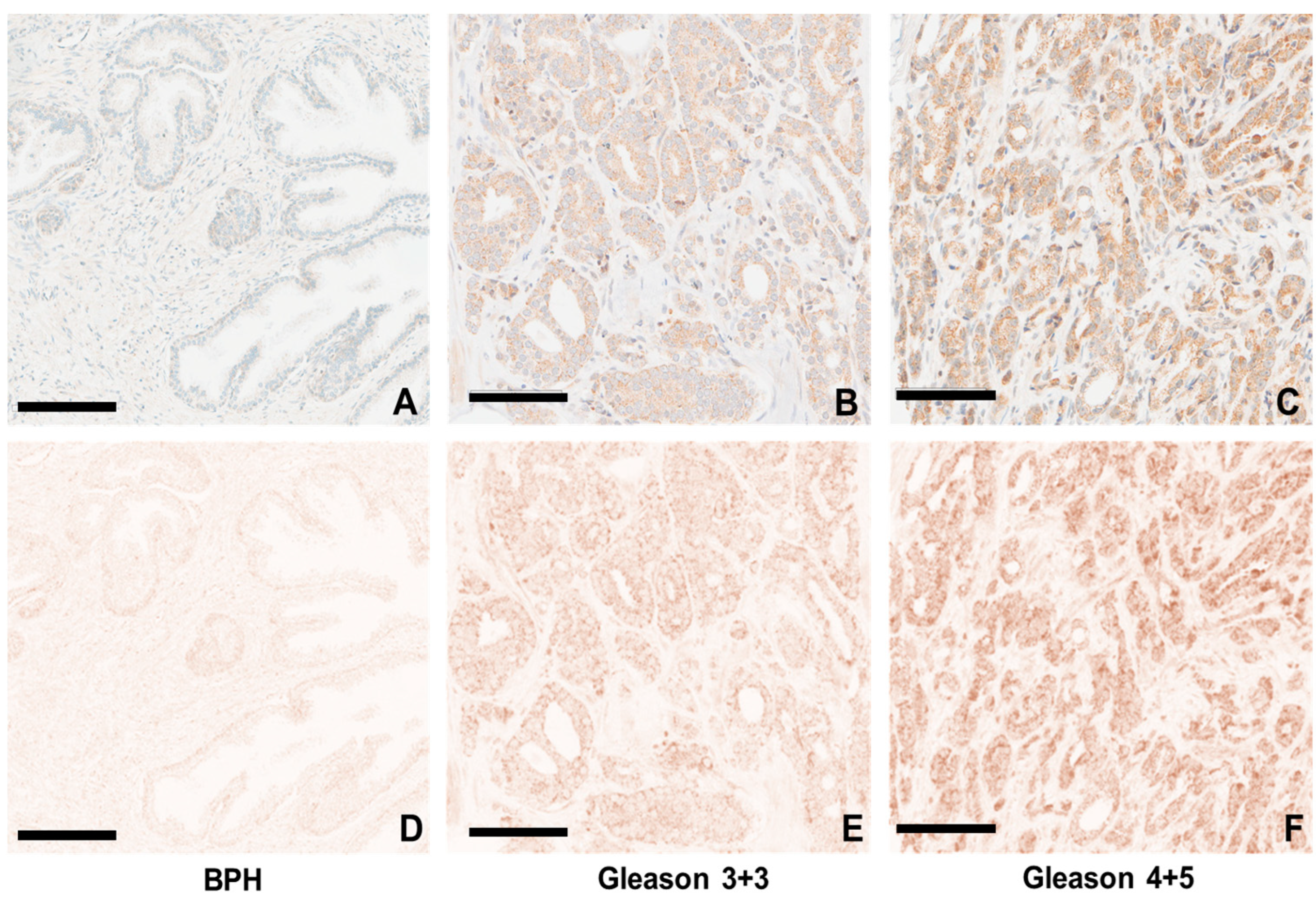 Cancers 16 03659 g007