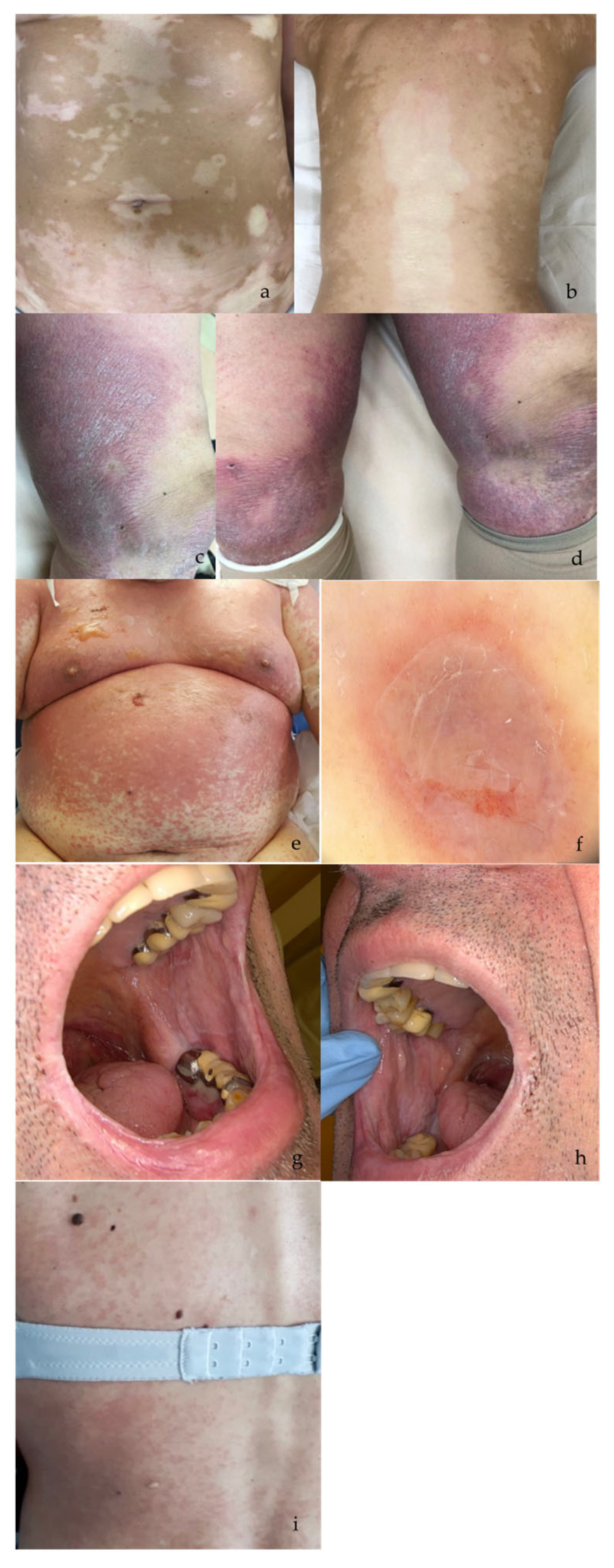 Cancers 16 03679 g001