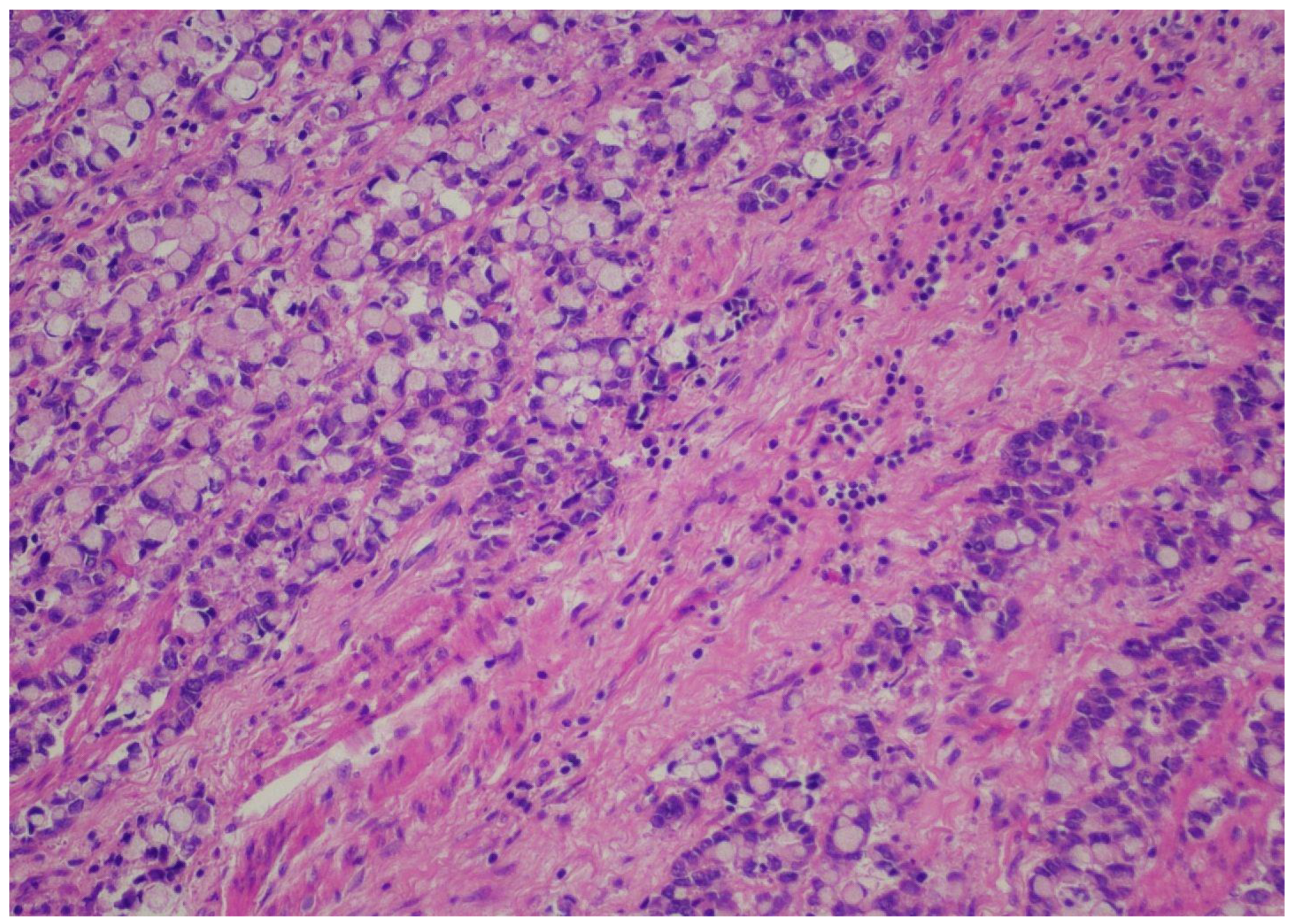 Cancers 16 03694 g002