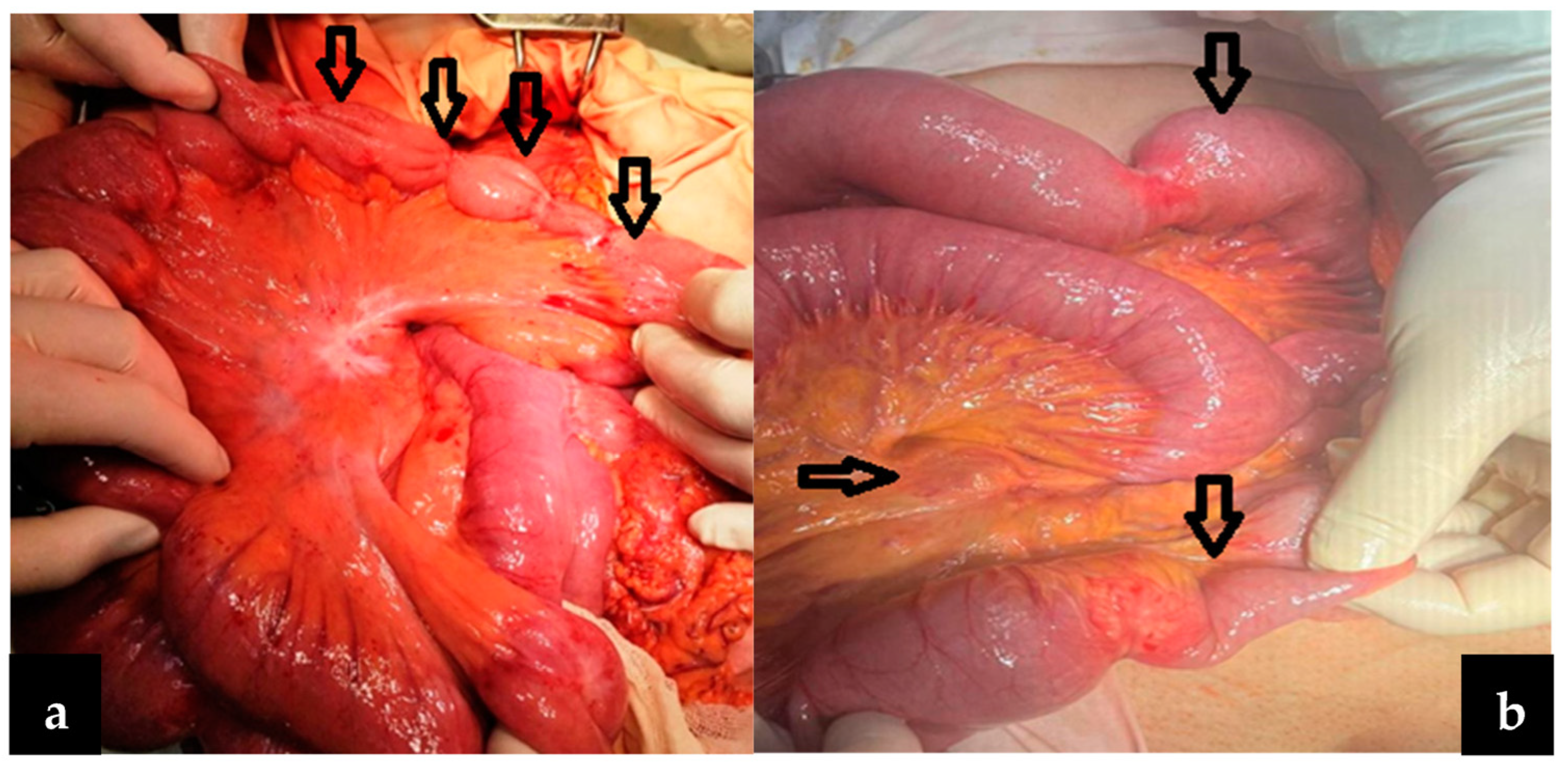 Cancers 16 03713 g002