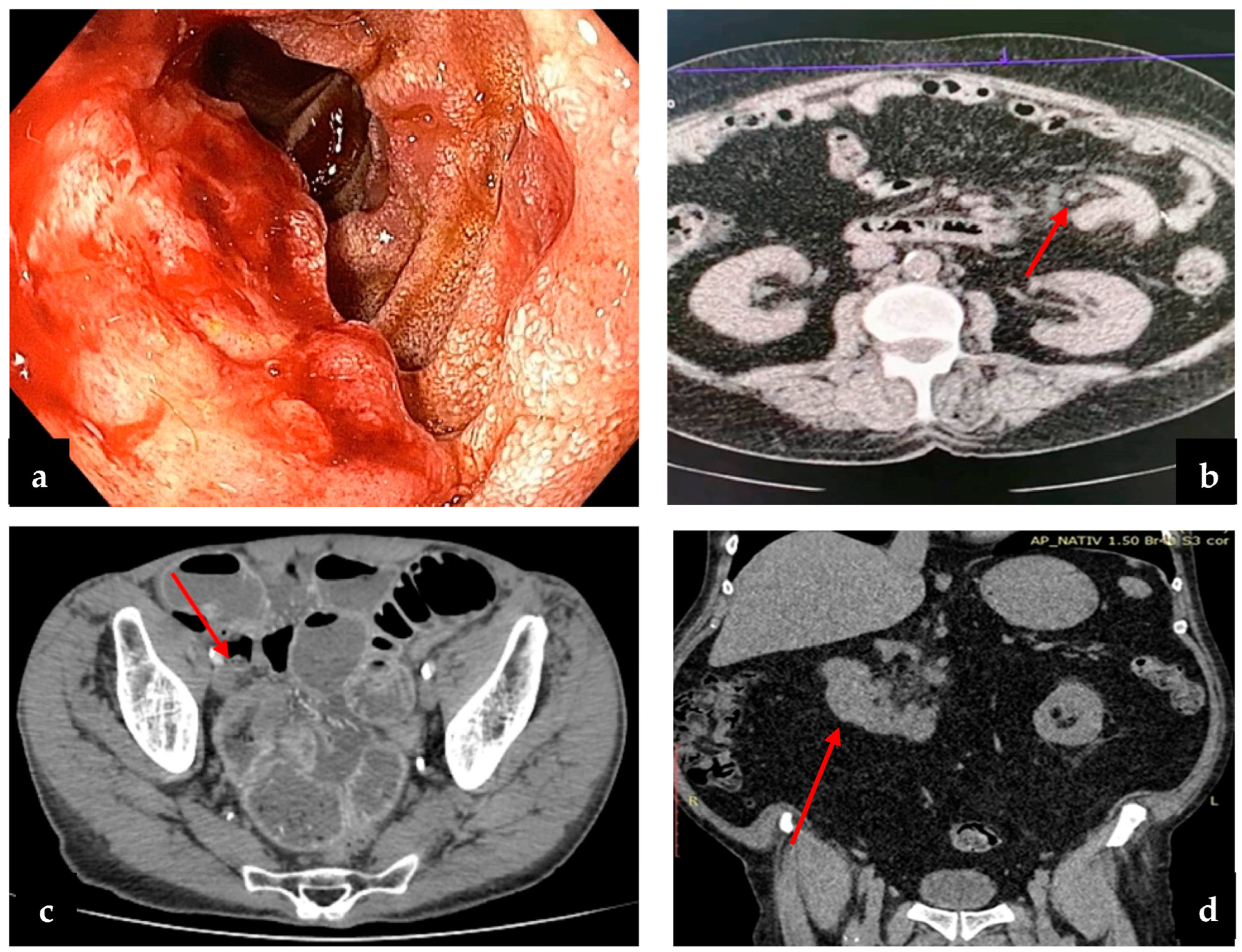 Cancers 16 03713 g004