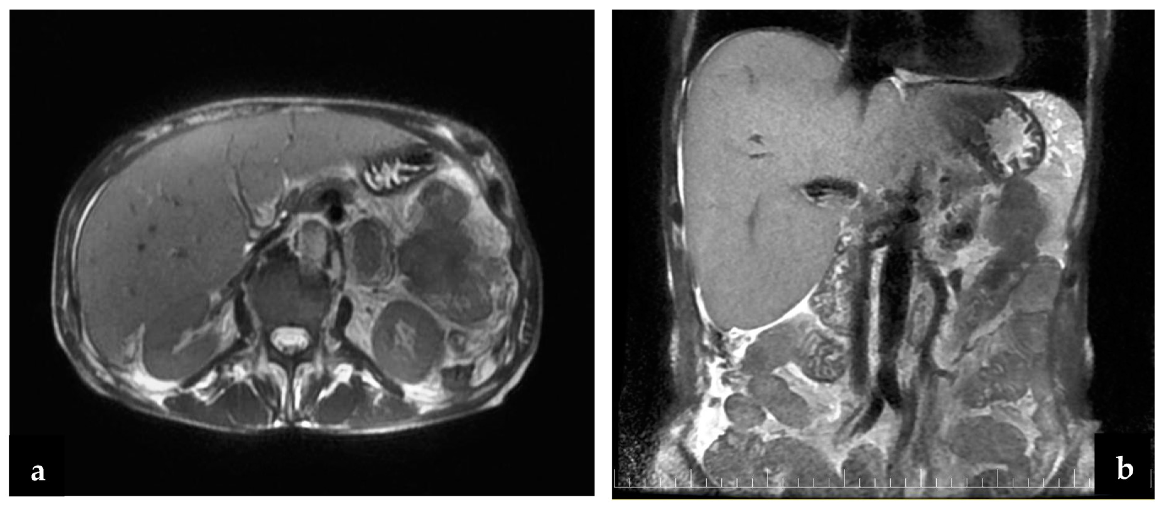 Cancers 16 03713 g005