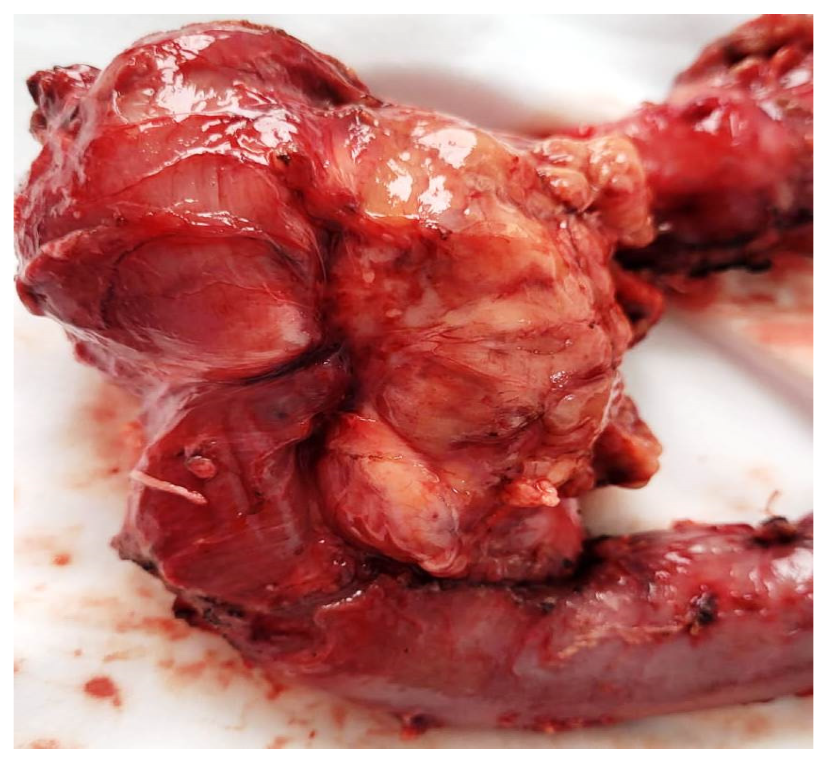 Cancers 16 03713 g008