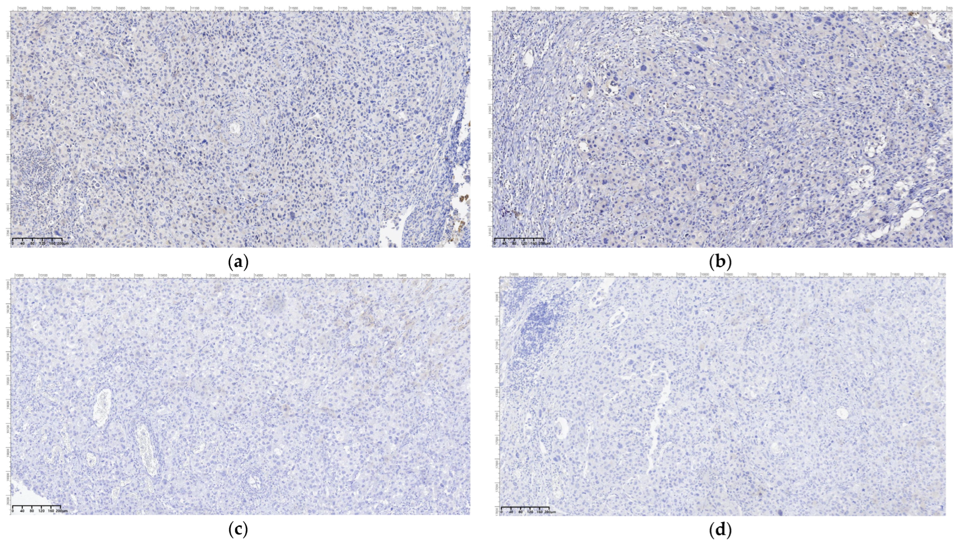 Cancers 16 03713 g011