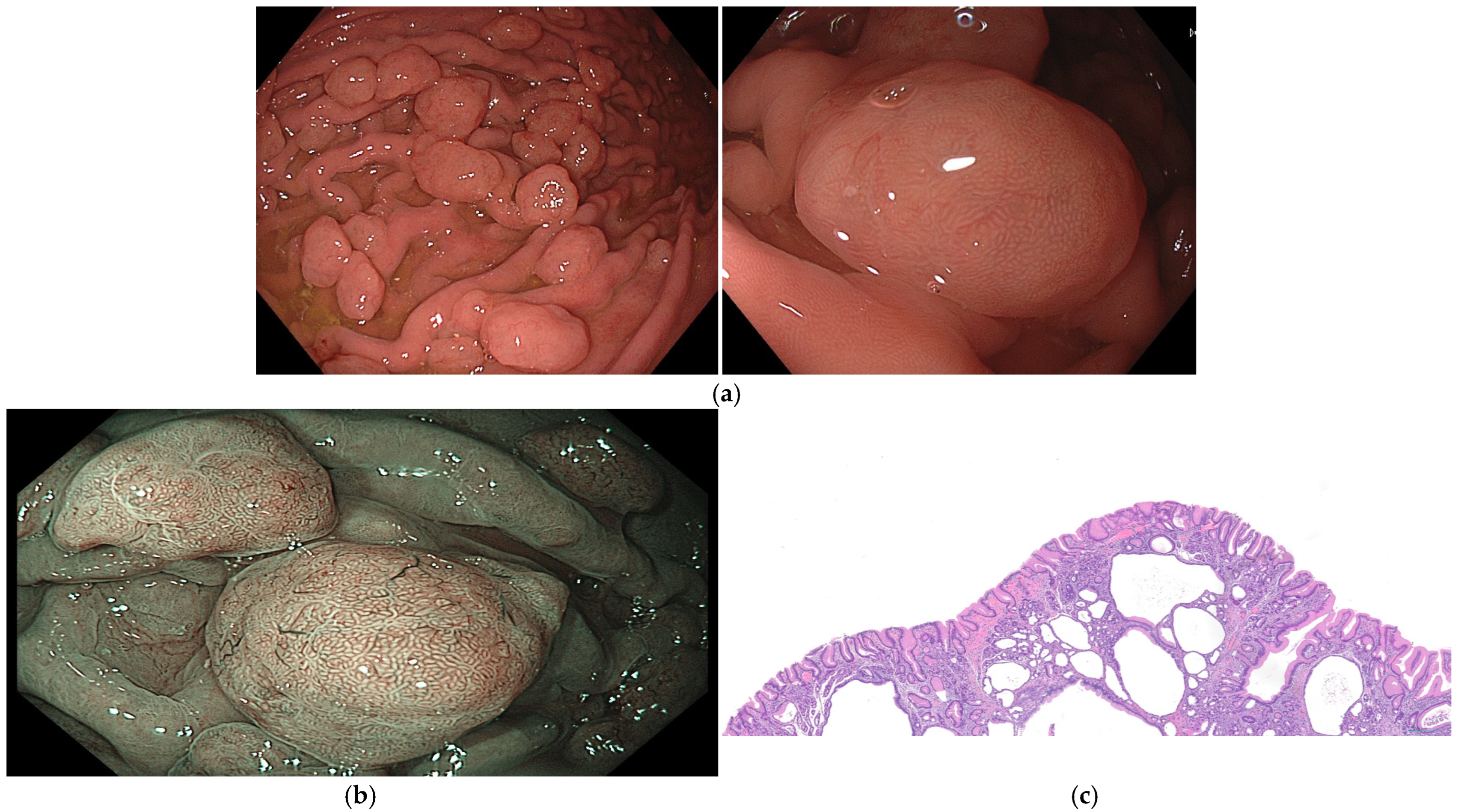Cancers 16 03771 g001
