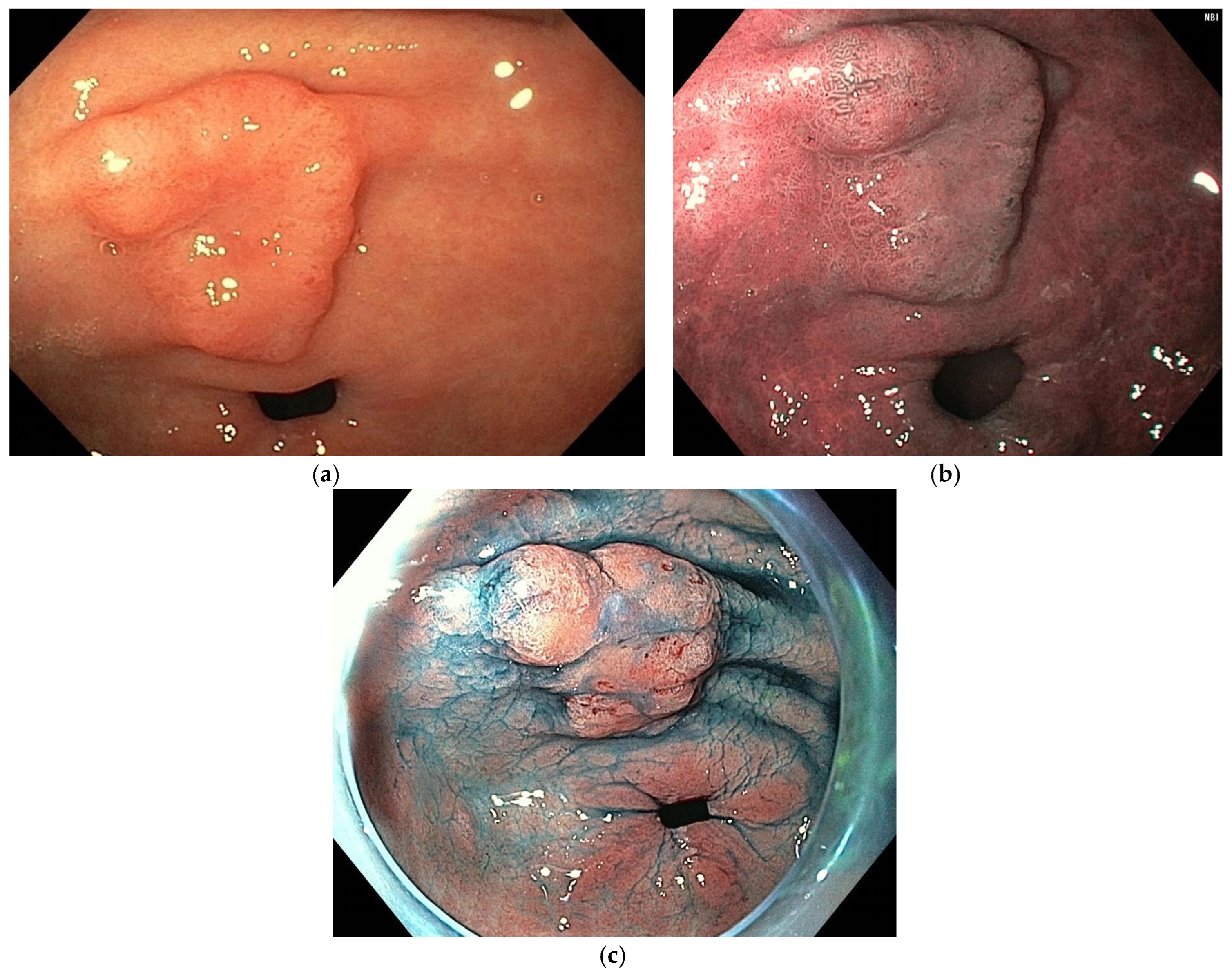 Cancers 16 03771 g004