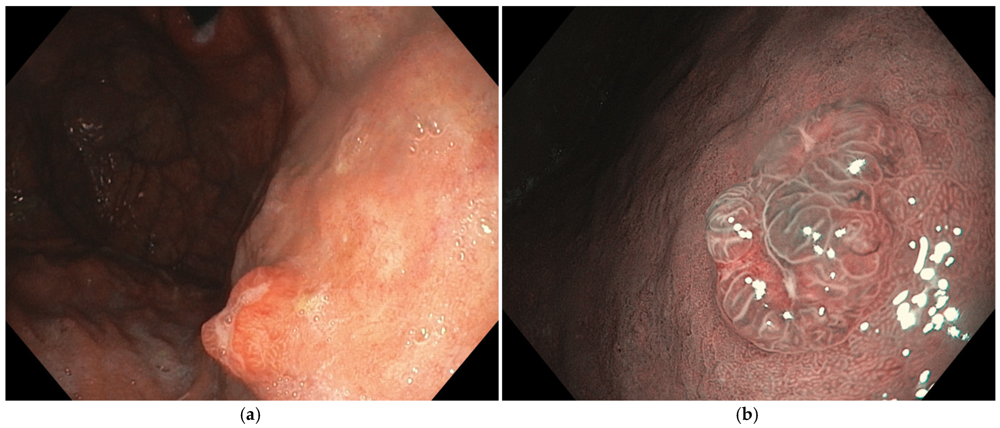 Cancers 16 03771 g005