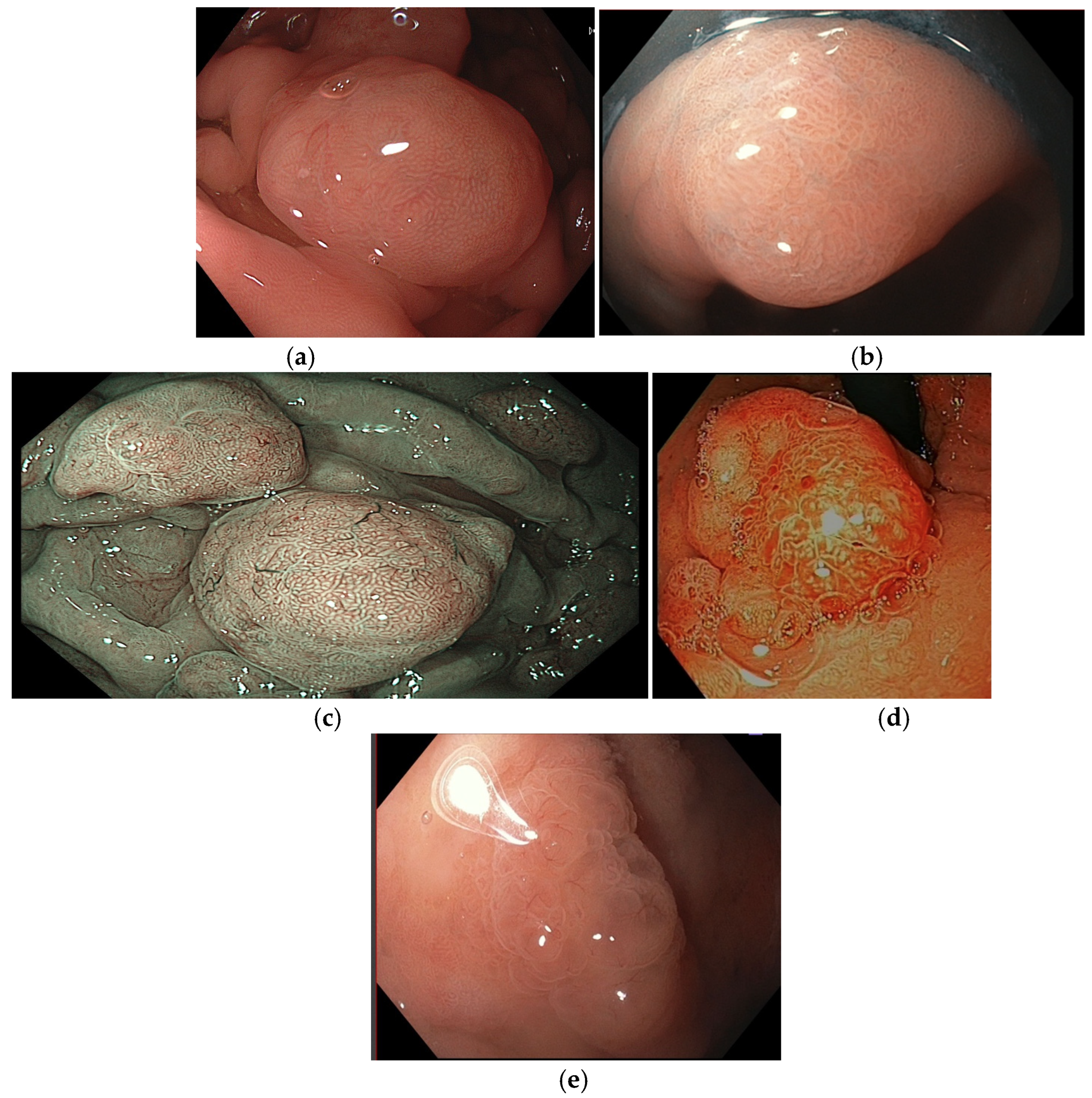 Cancers 16 03771 g006