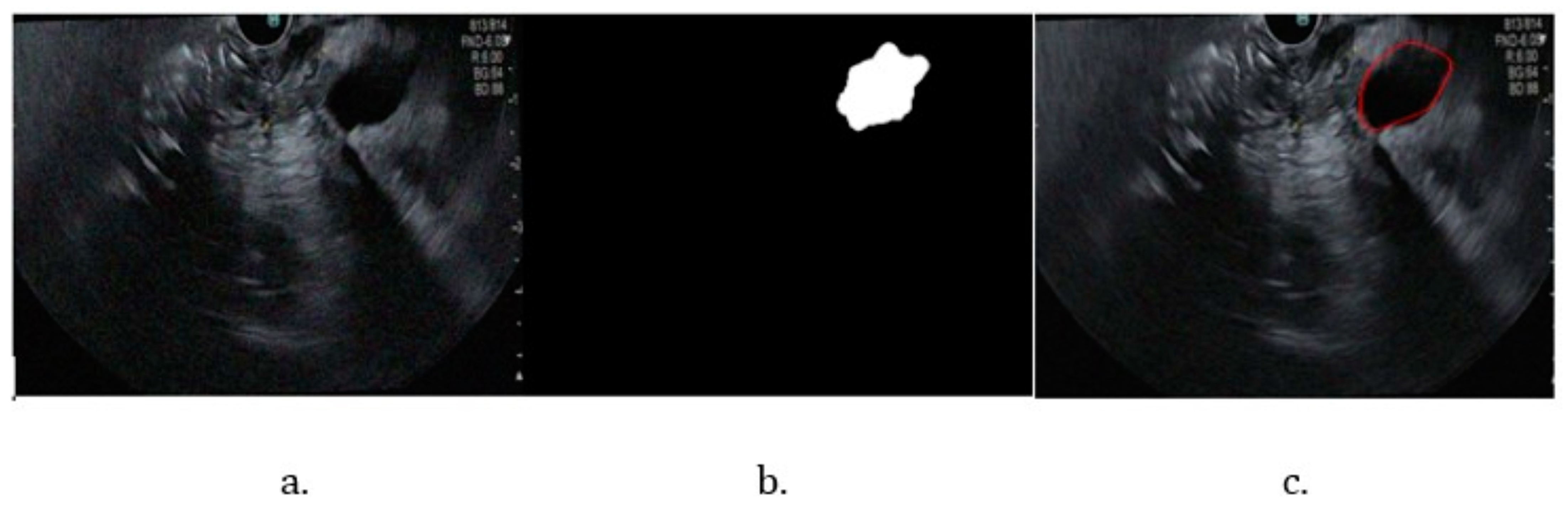 Cancers 16 03792 g006