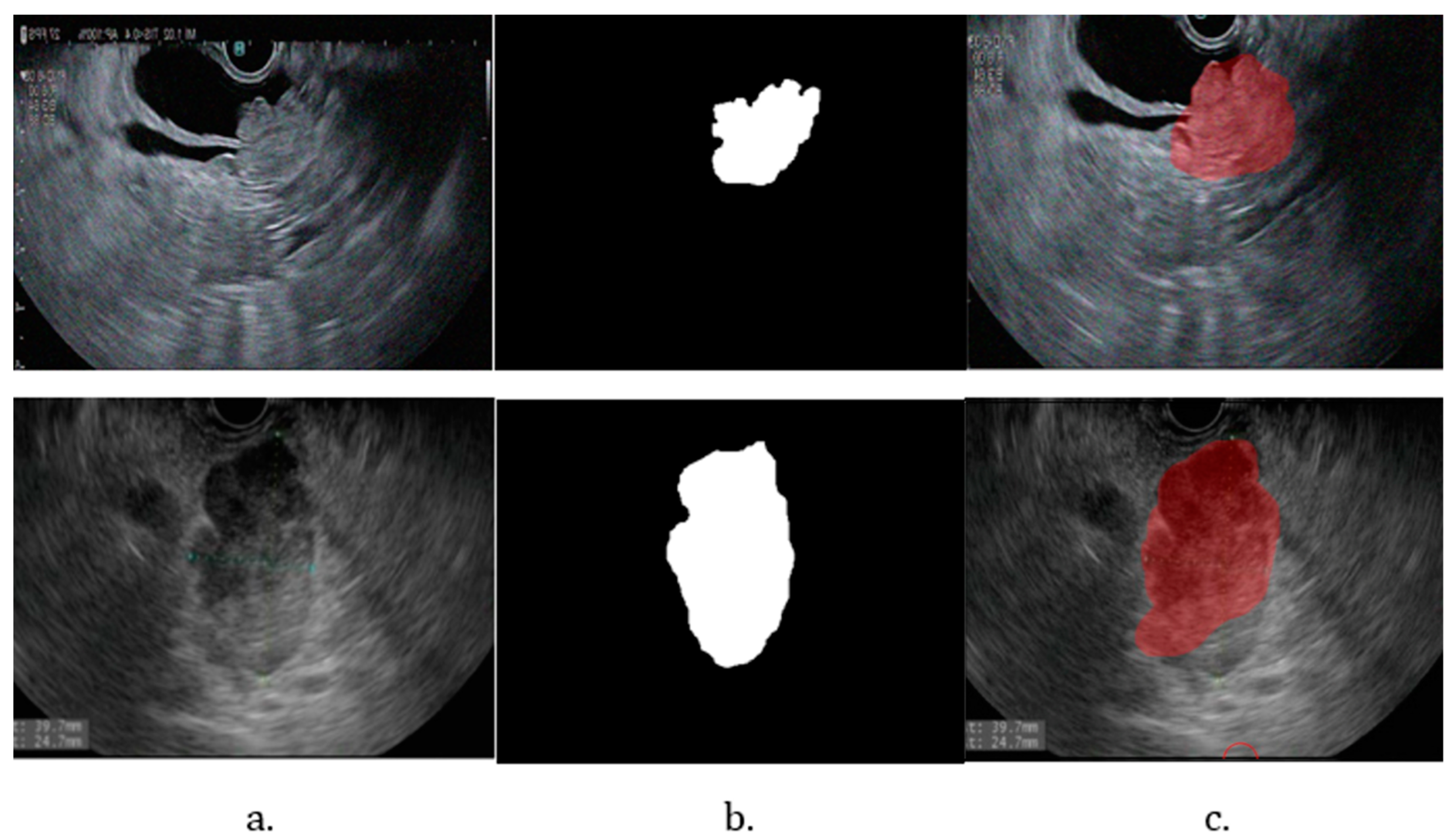 Cancers 16 03792 g008