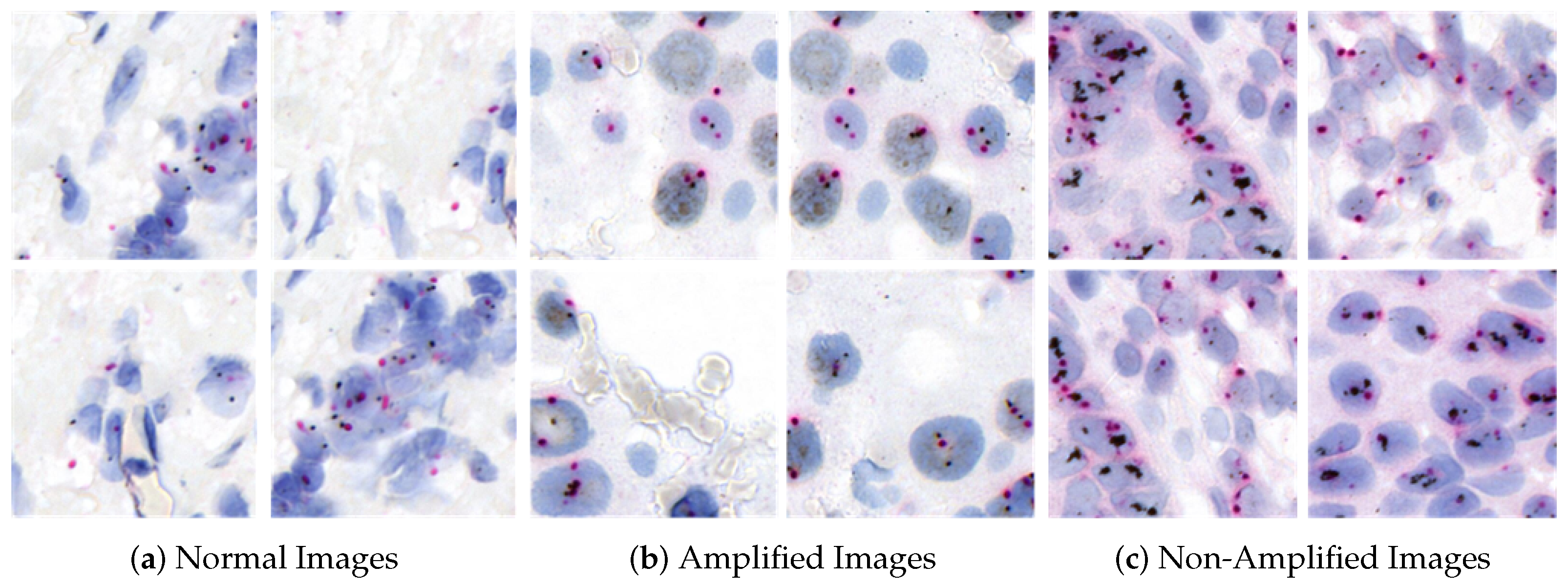 Cancers 16 03794 g005