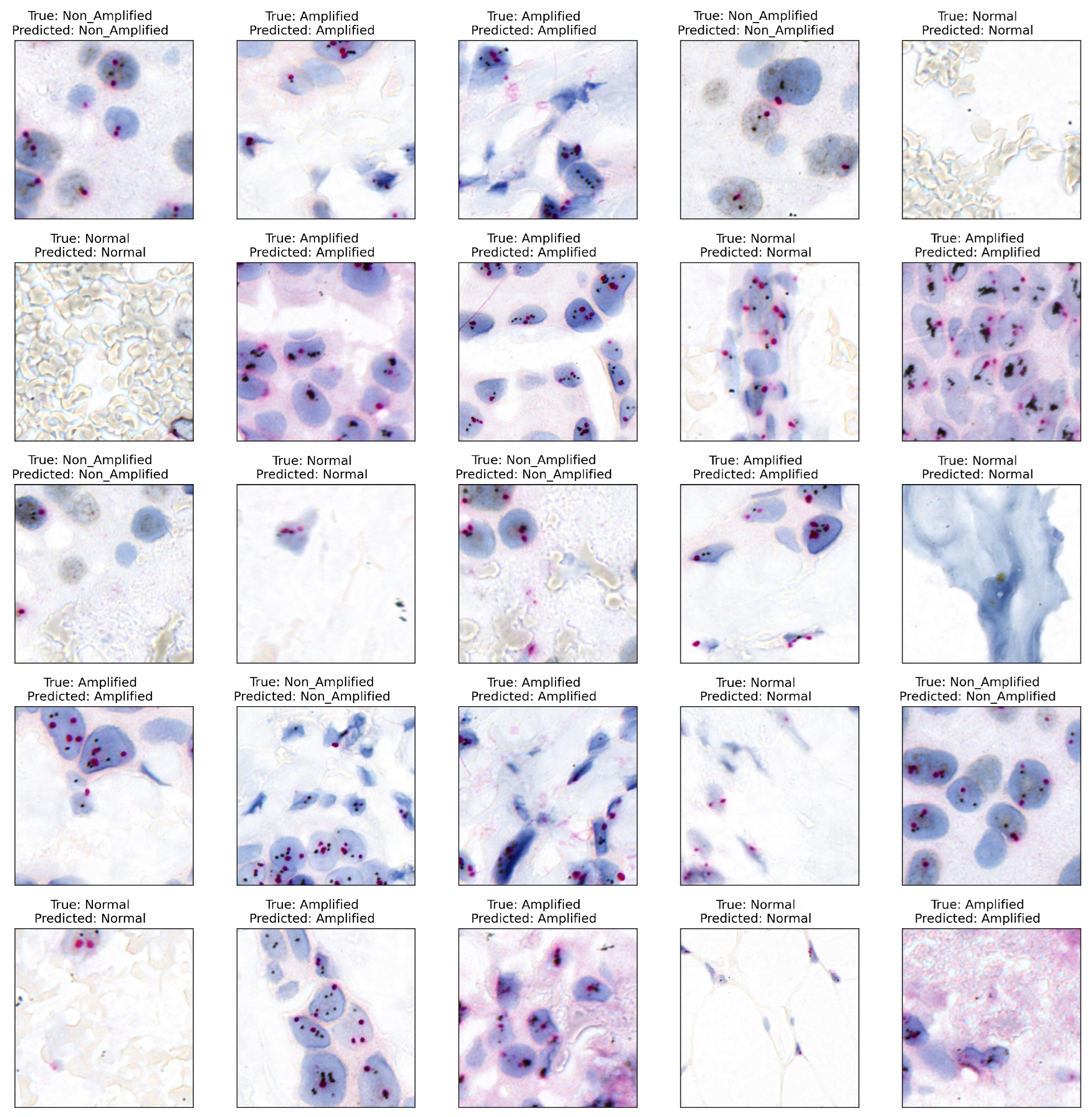 Cancers 16 03794 g011