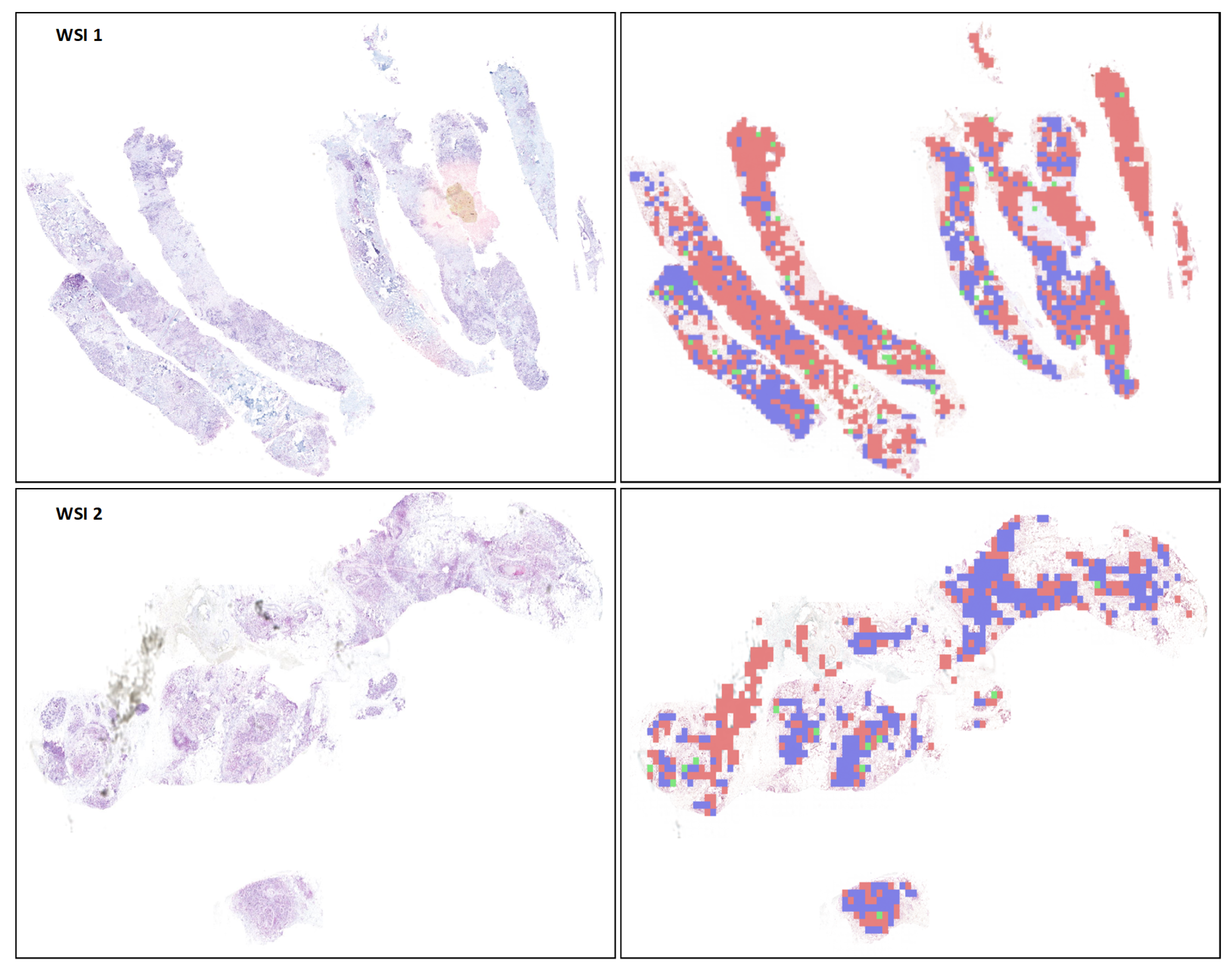 Cancers 16 03794 g012