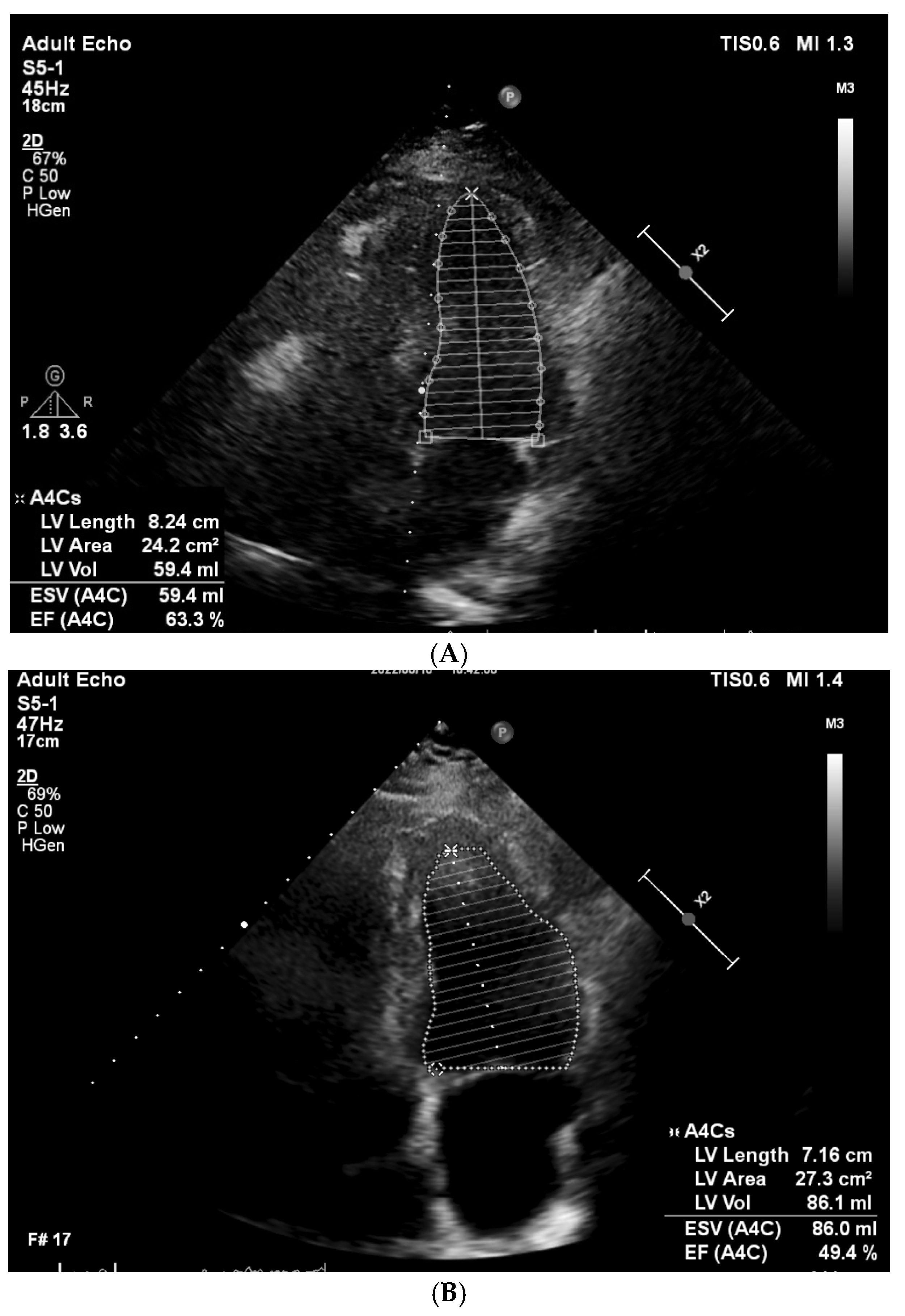 Cancers 16 03808 g002 Cancers 16 03808 g002