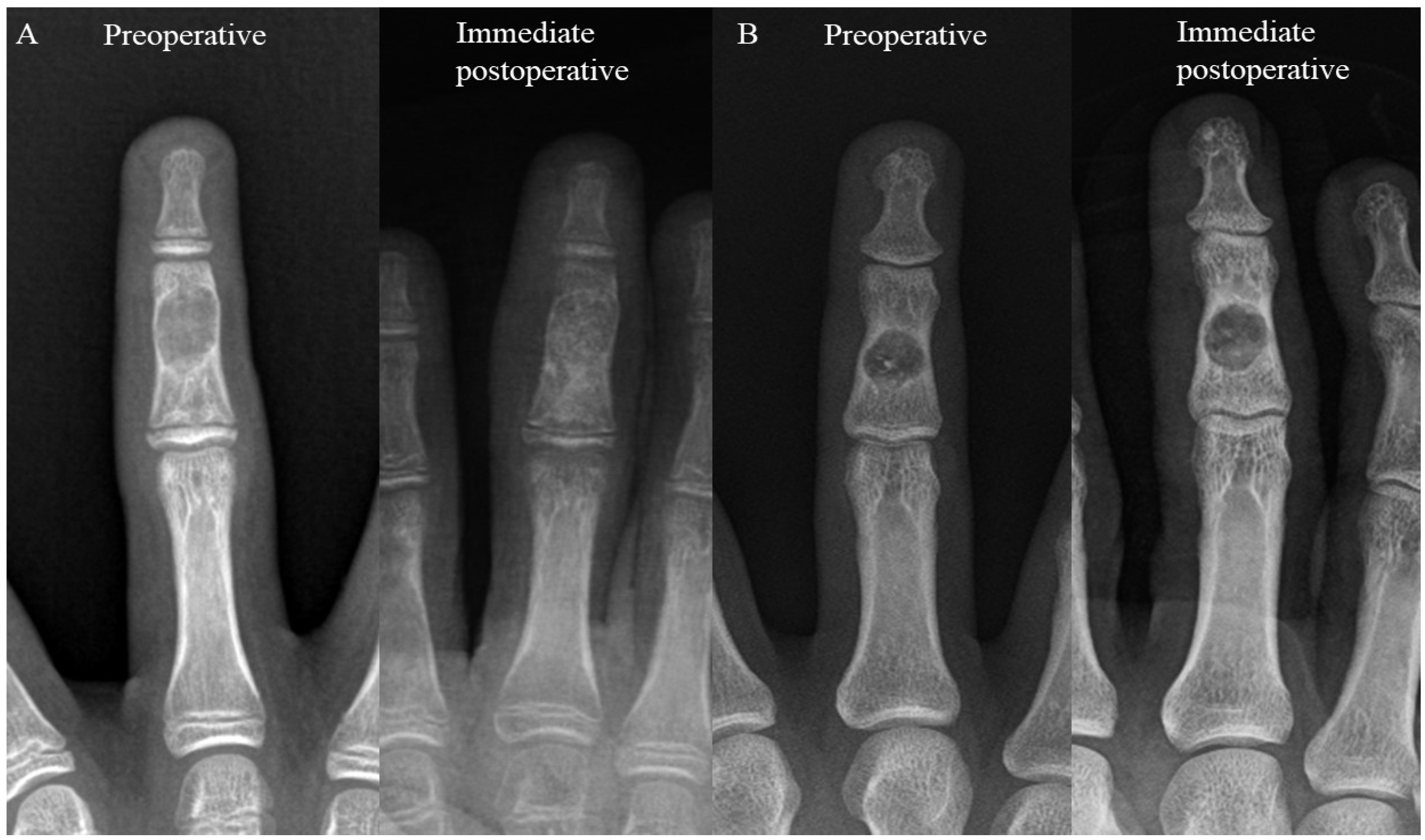 Cancers 16 03811 g001 Cancers 16 03811 g001
