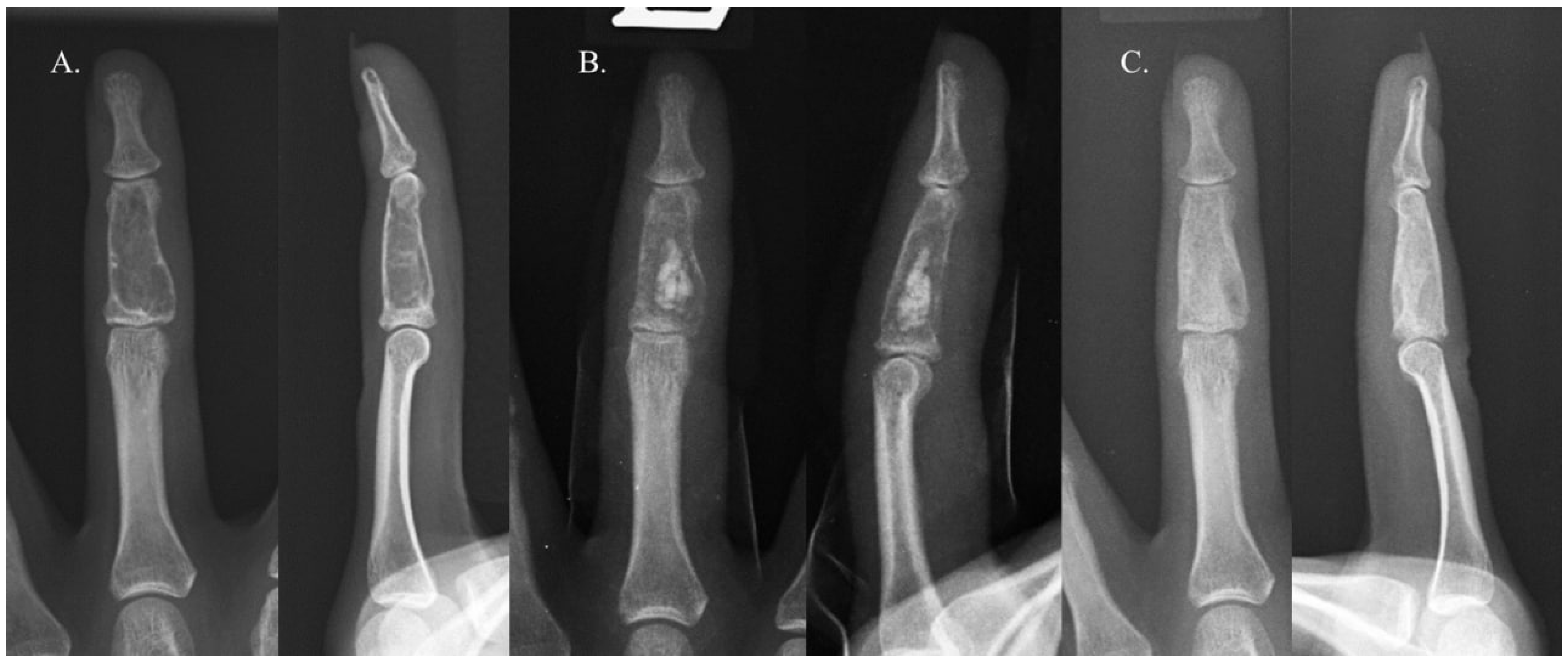 Cancers 16 03811 g002 Cancers 16 03811 g002