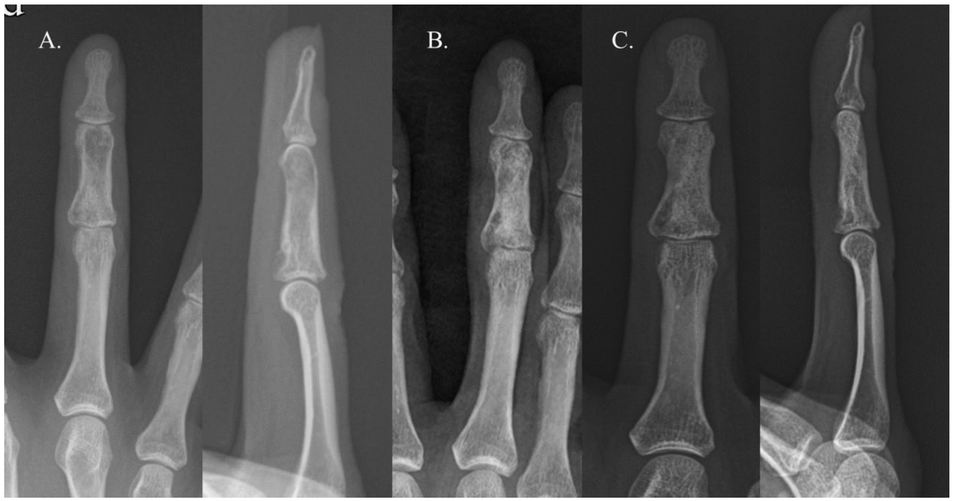 Cancers 16 03811 g003 Cancers 16 03811 g003