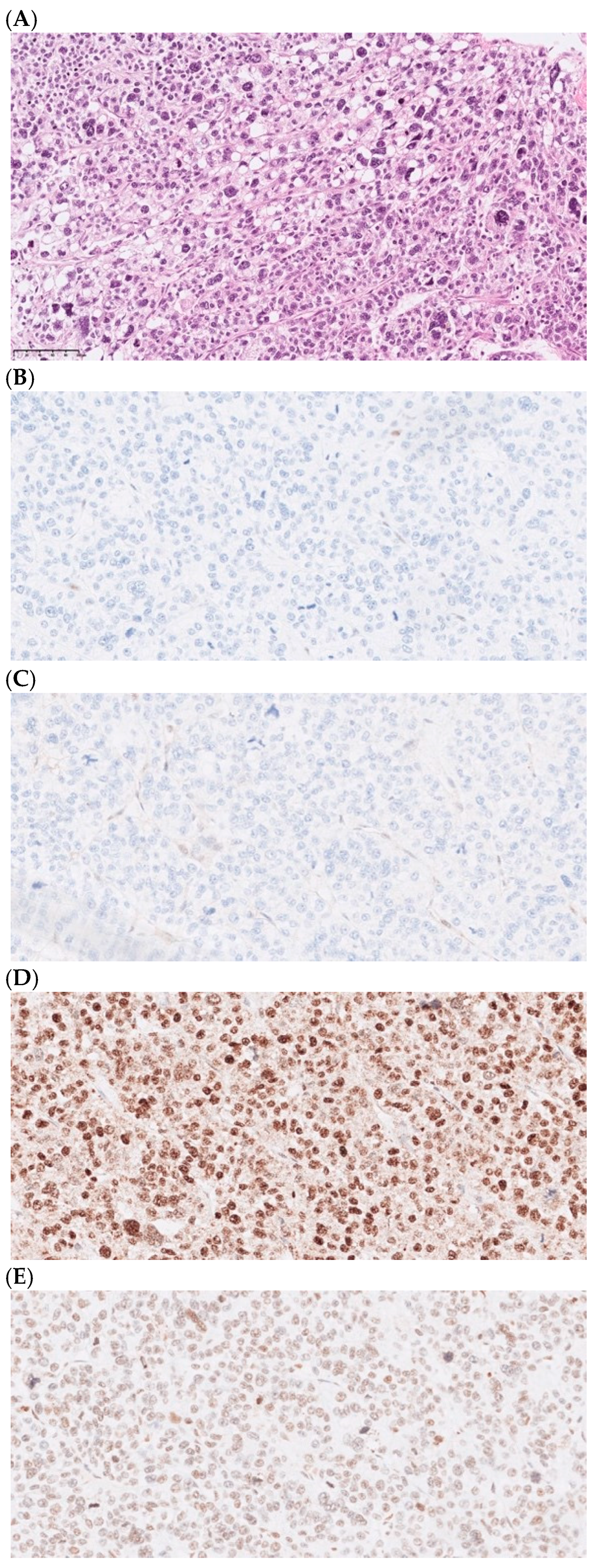 Cancers 16 03816 g002