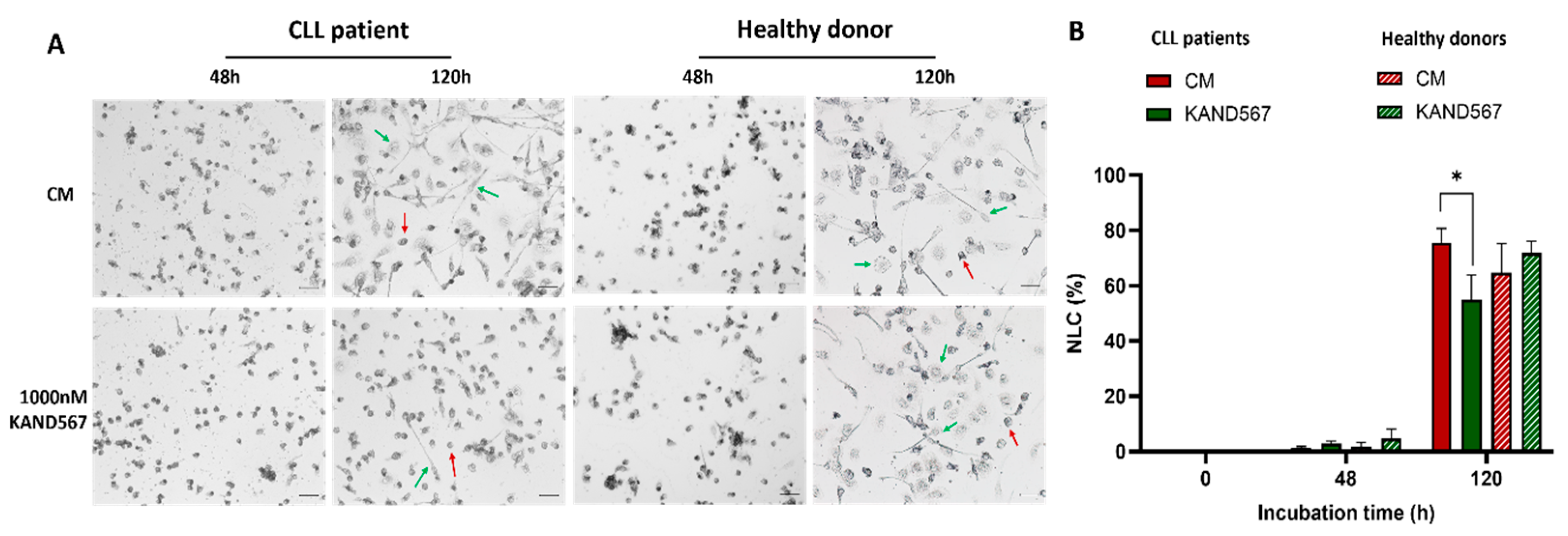 Cancers 16 03821 g005