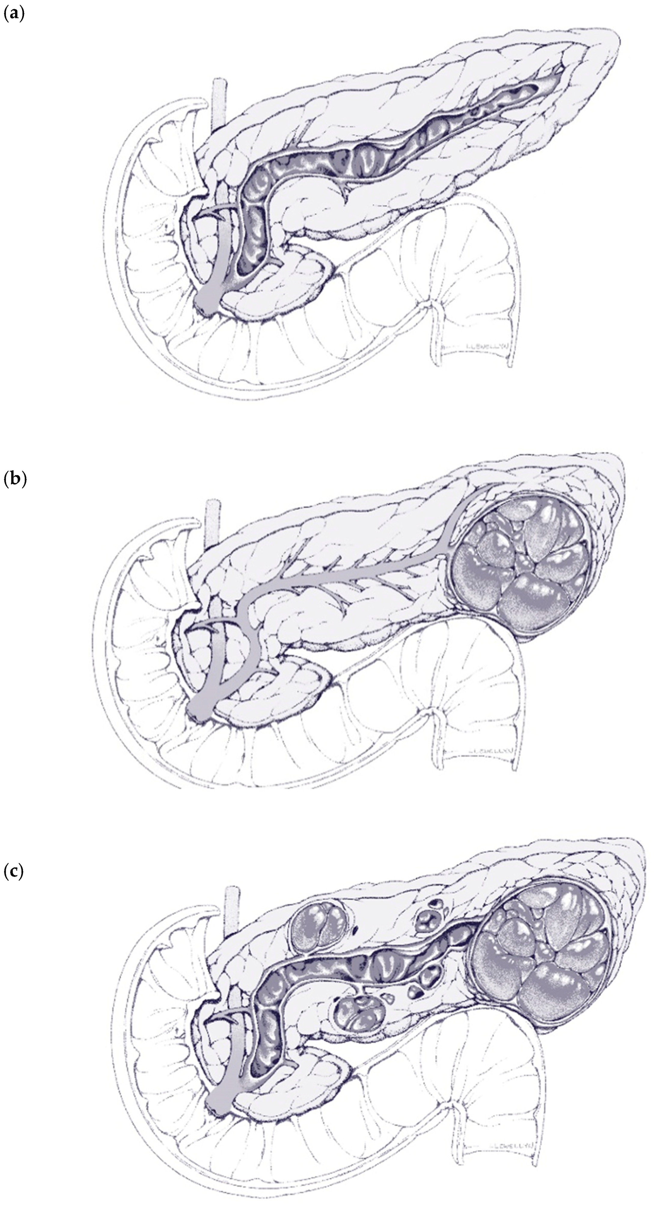 Cancers 16 03825 g001