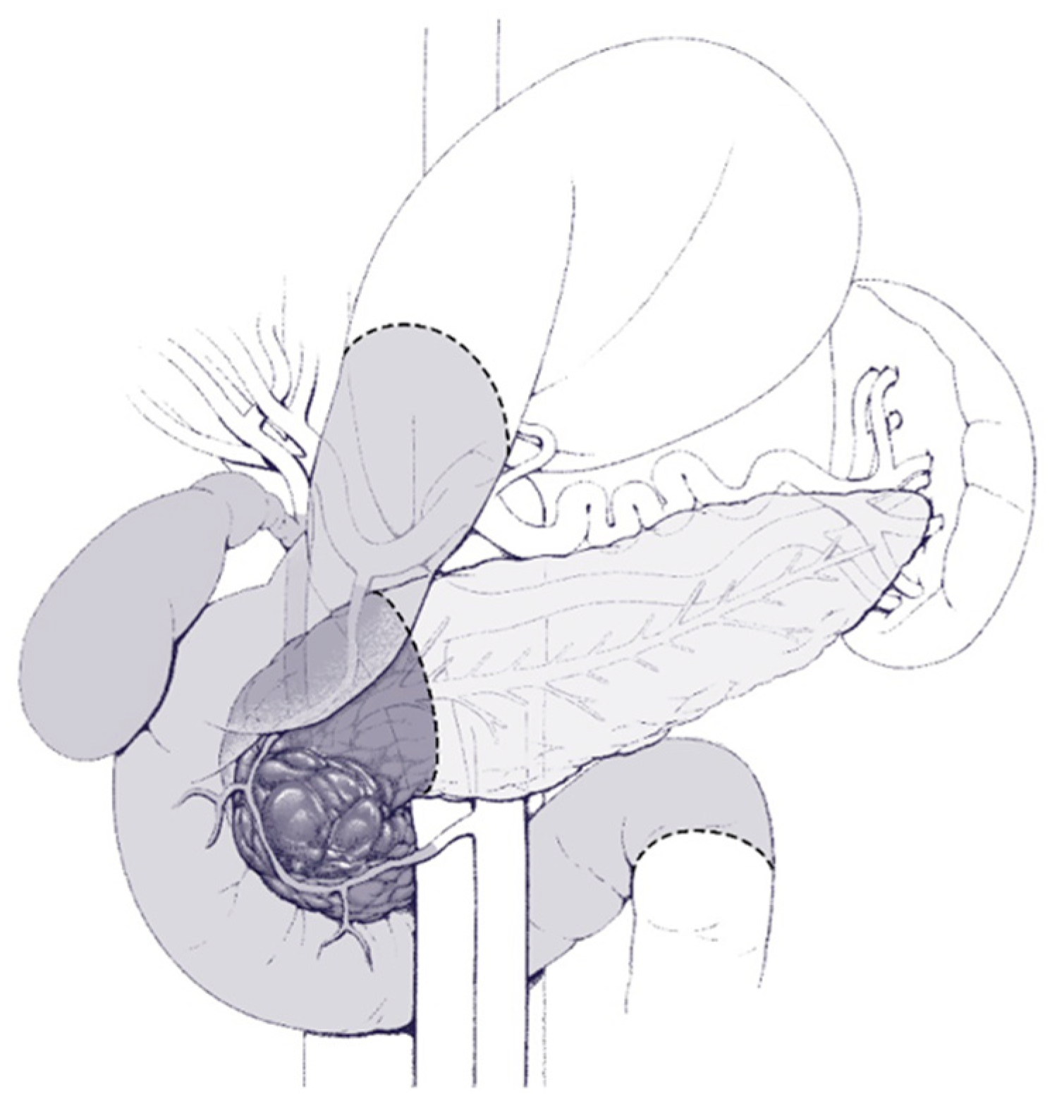 Cancers 16 03825 g003