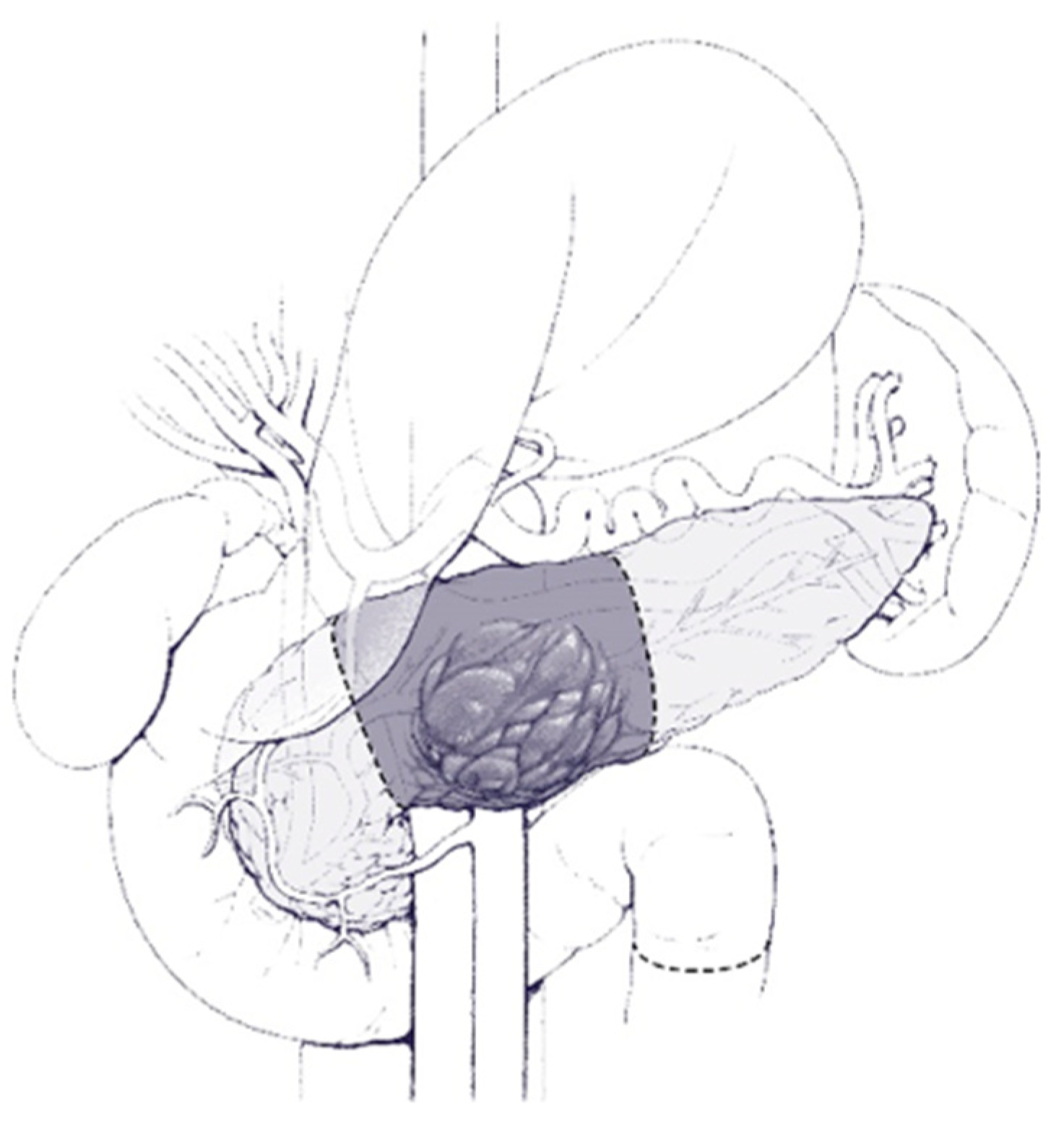 Cancers 16 03825 g005