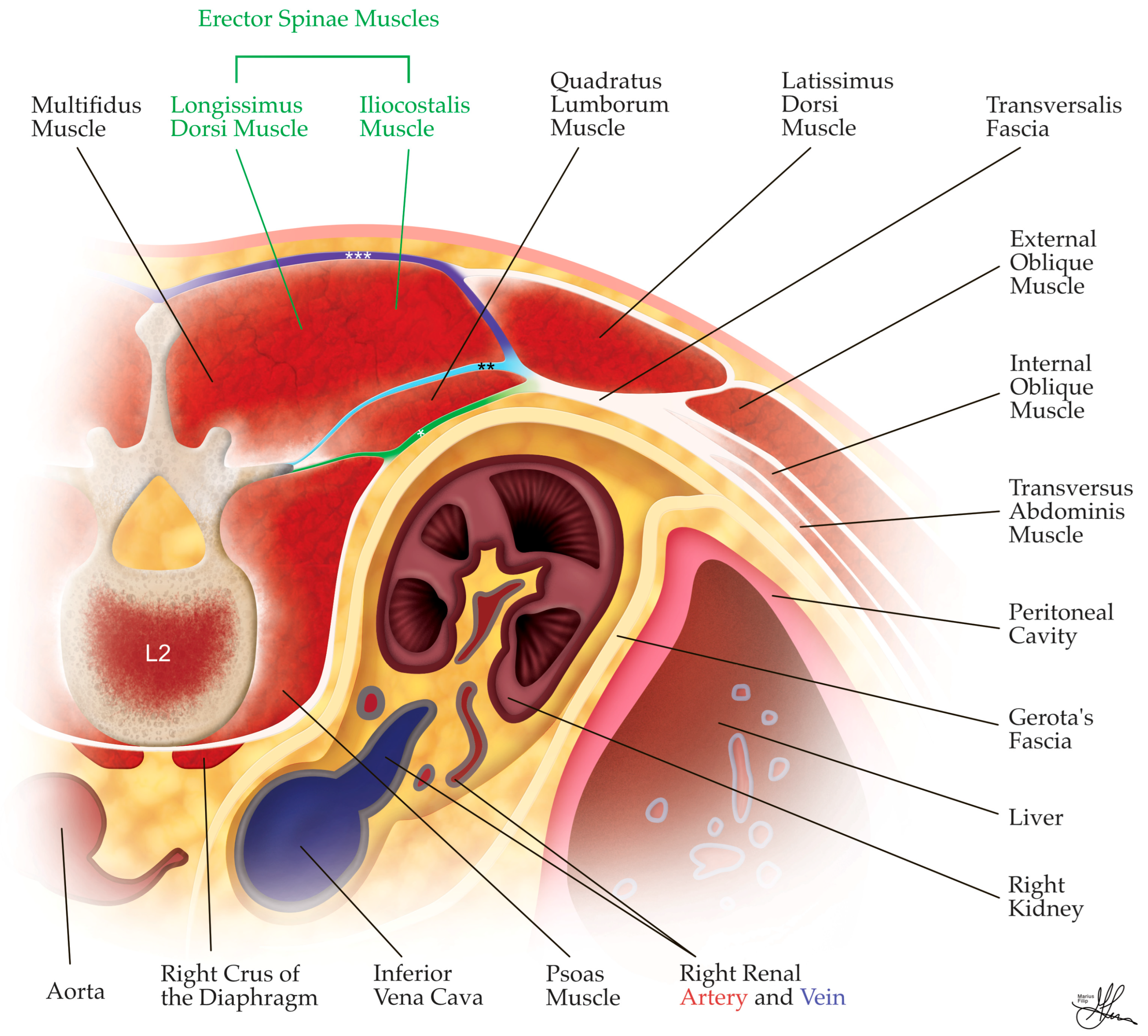 Cancers 16 03841 g003