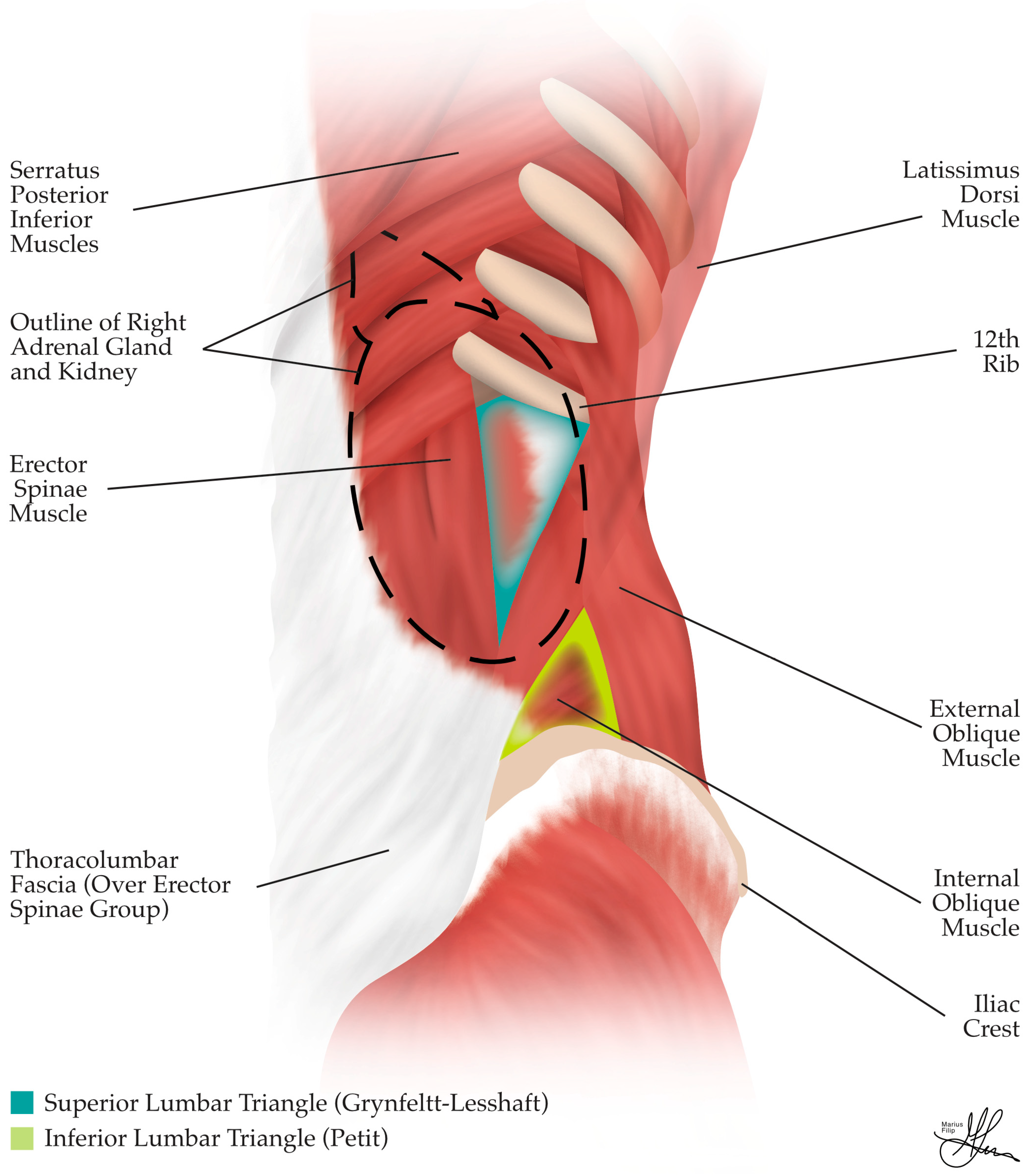 Cancers 16 03841 g004
