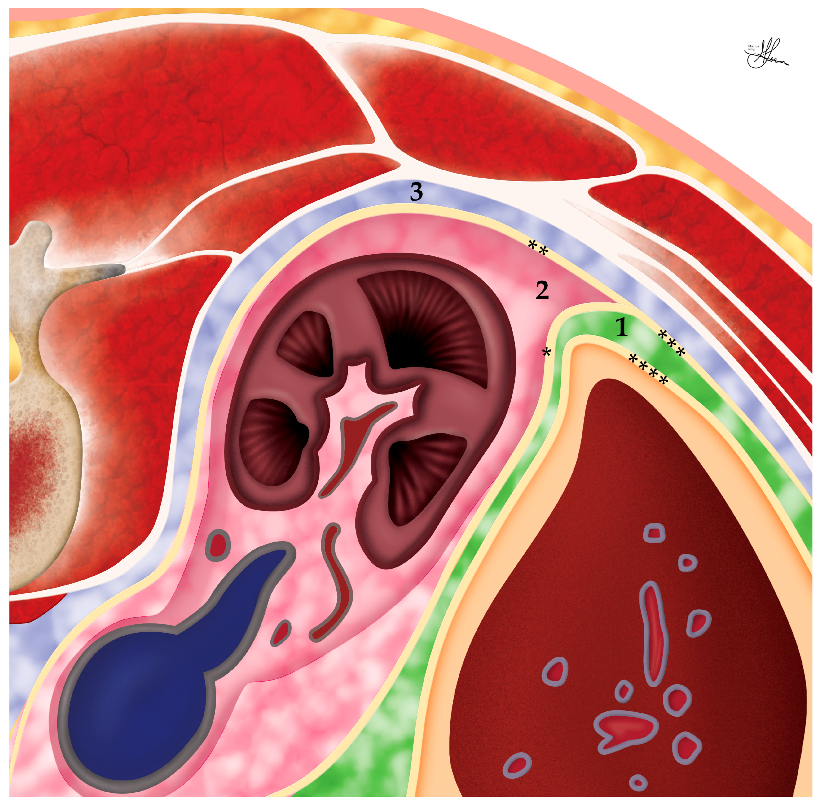 Cancers 16 03841 g005