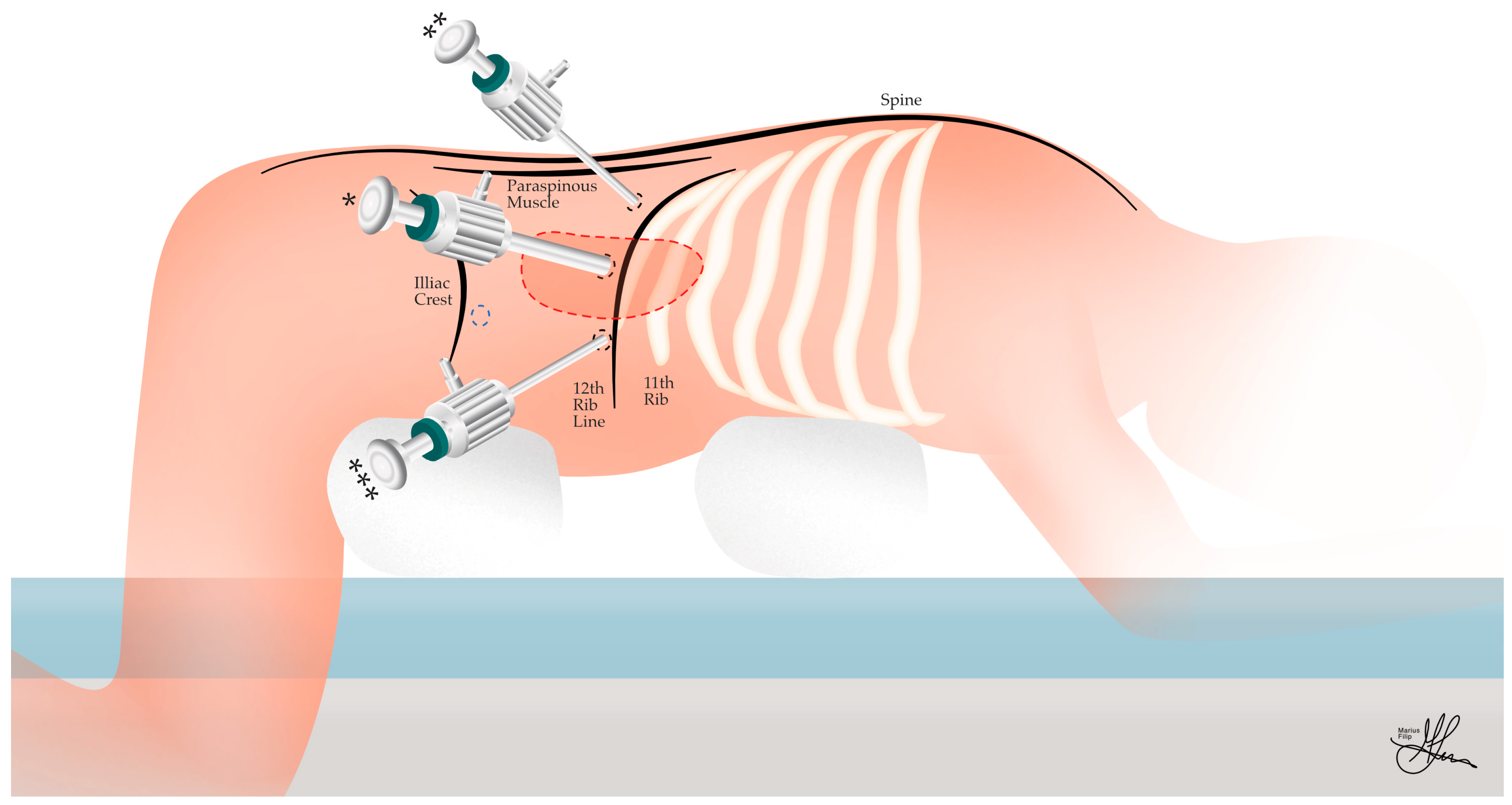 Cancers 16 03841 g006
