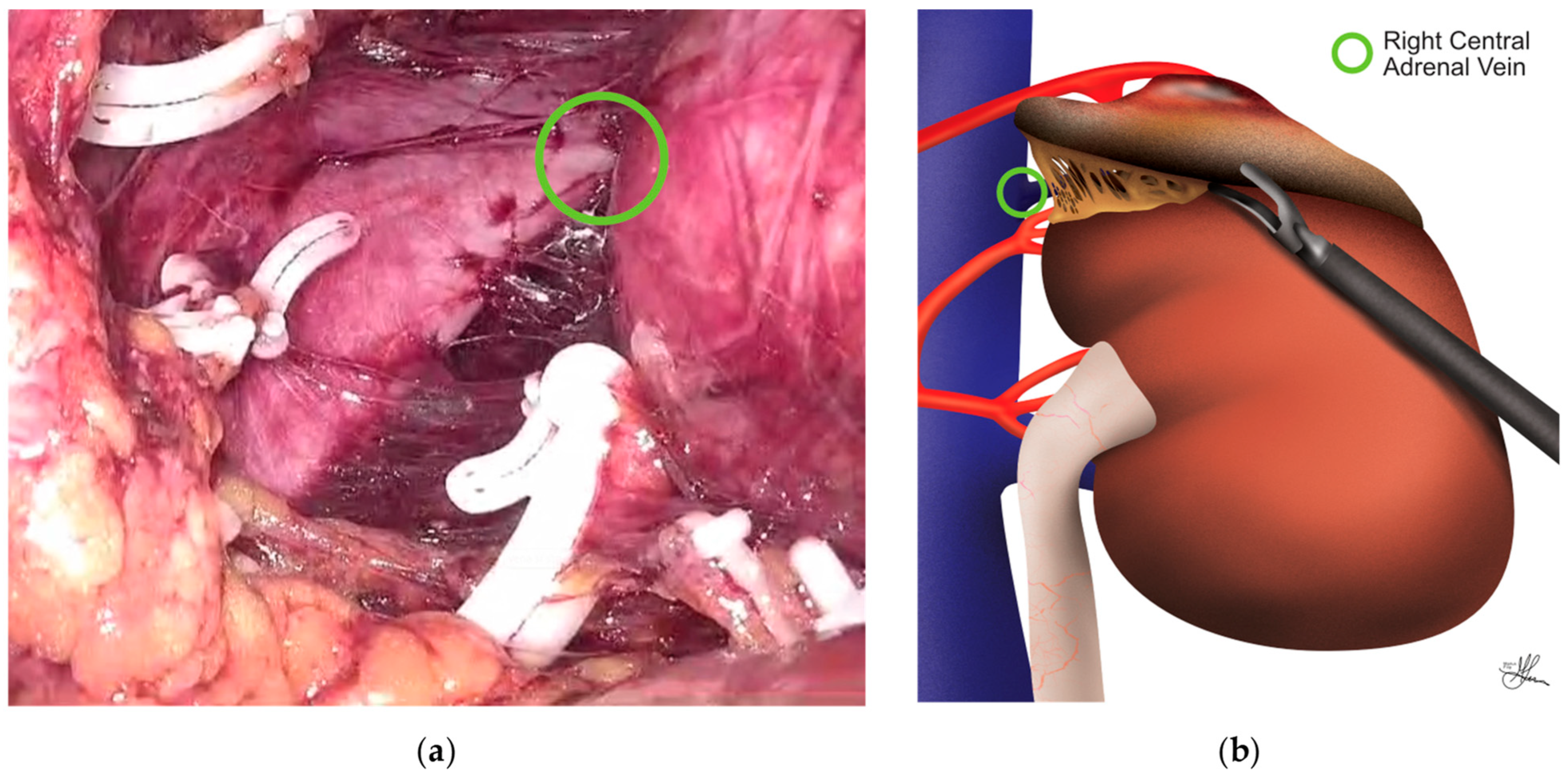 Cancers 16 03841 g008