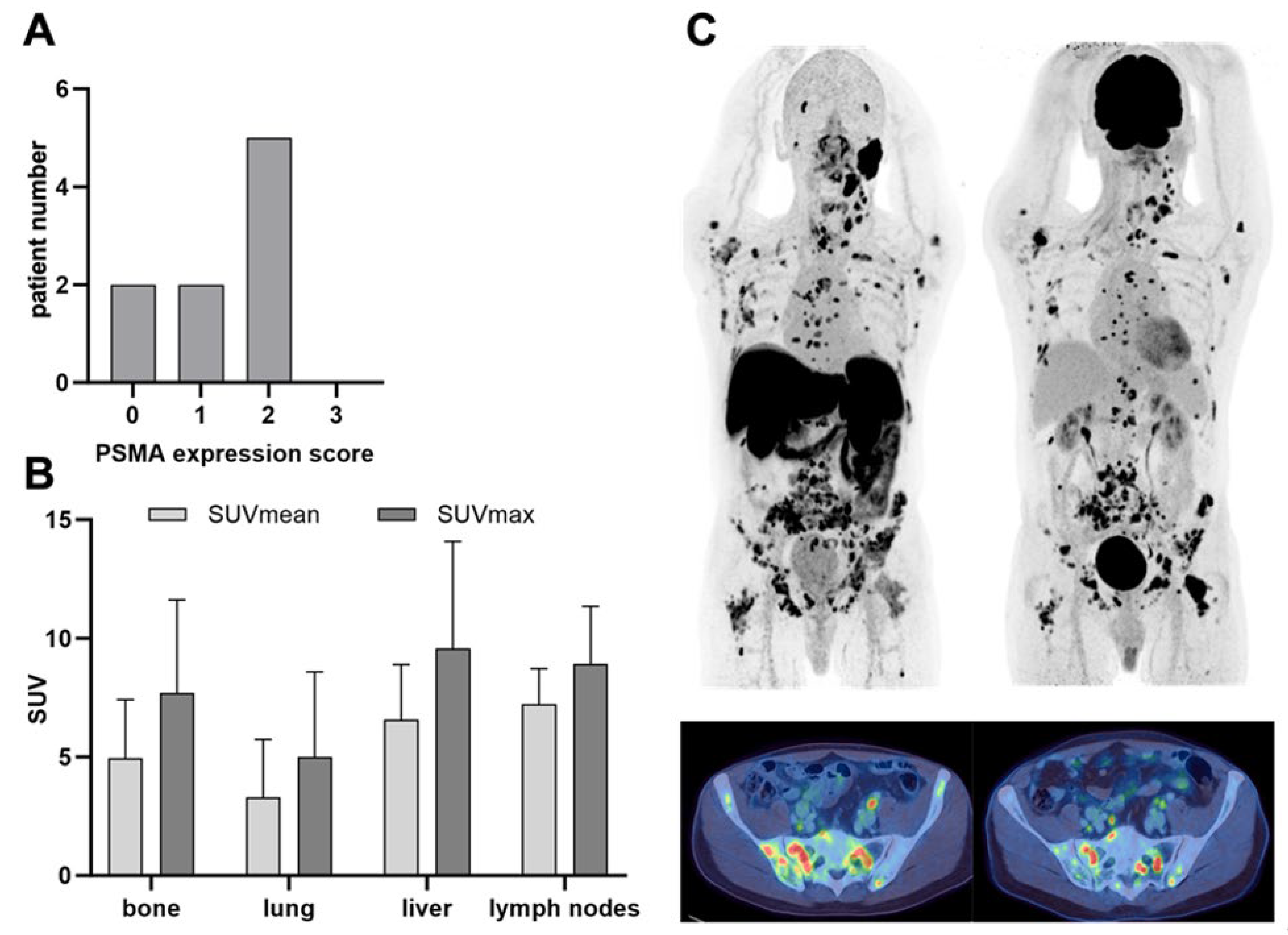Cancers 16 03843 g002