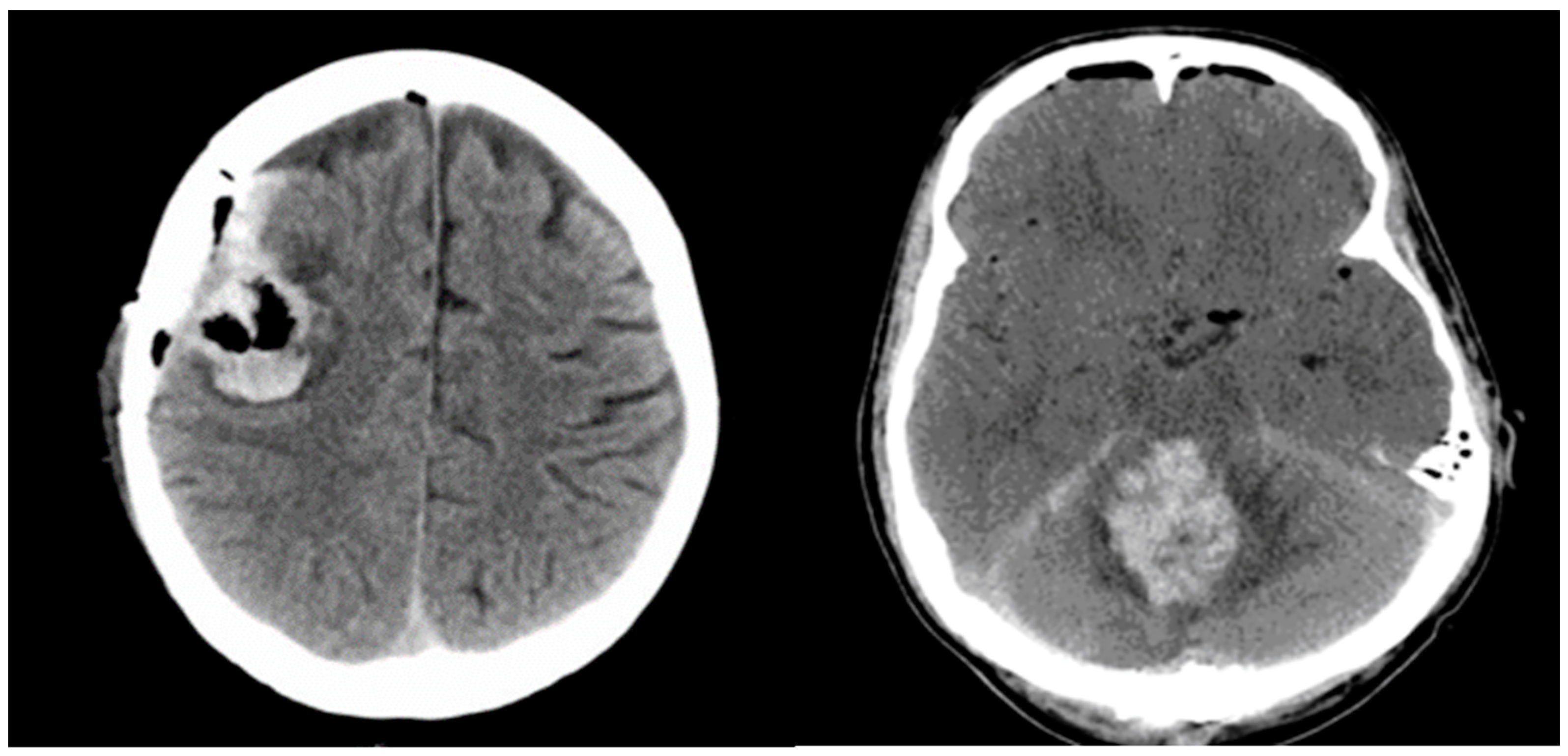 Cancers 16 03845 g002