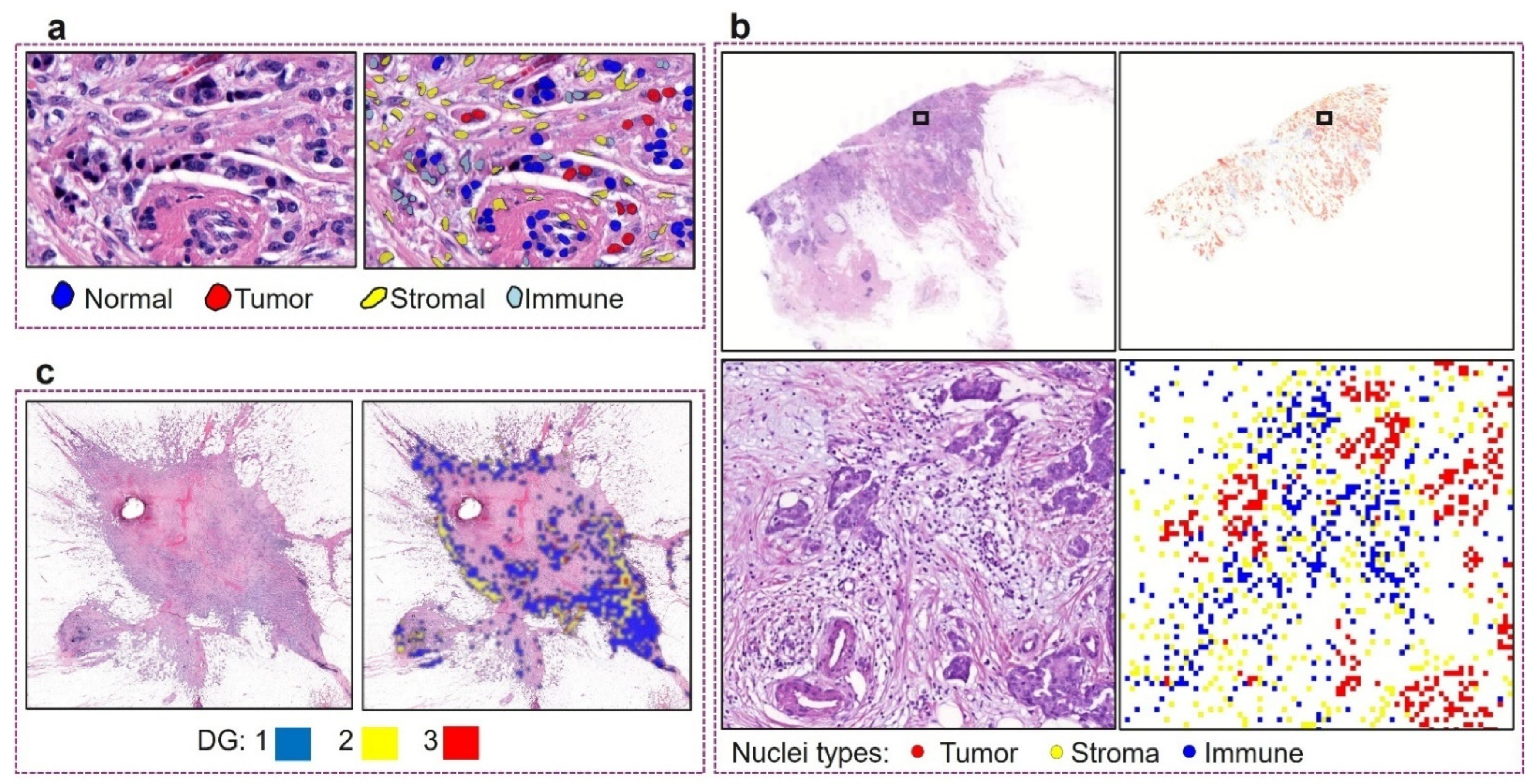 Cancers 16 03849 g003
