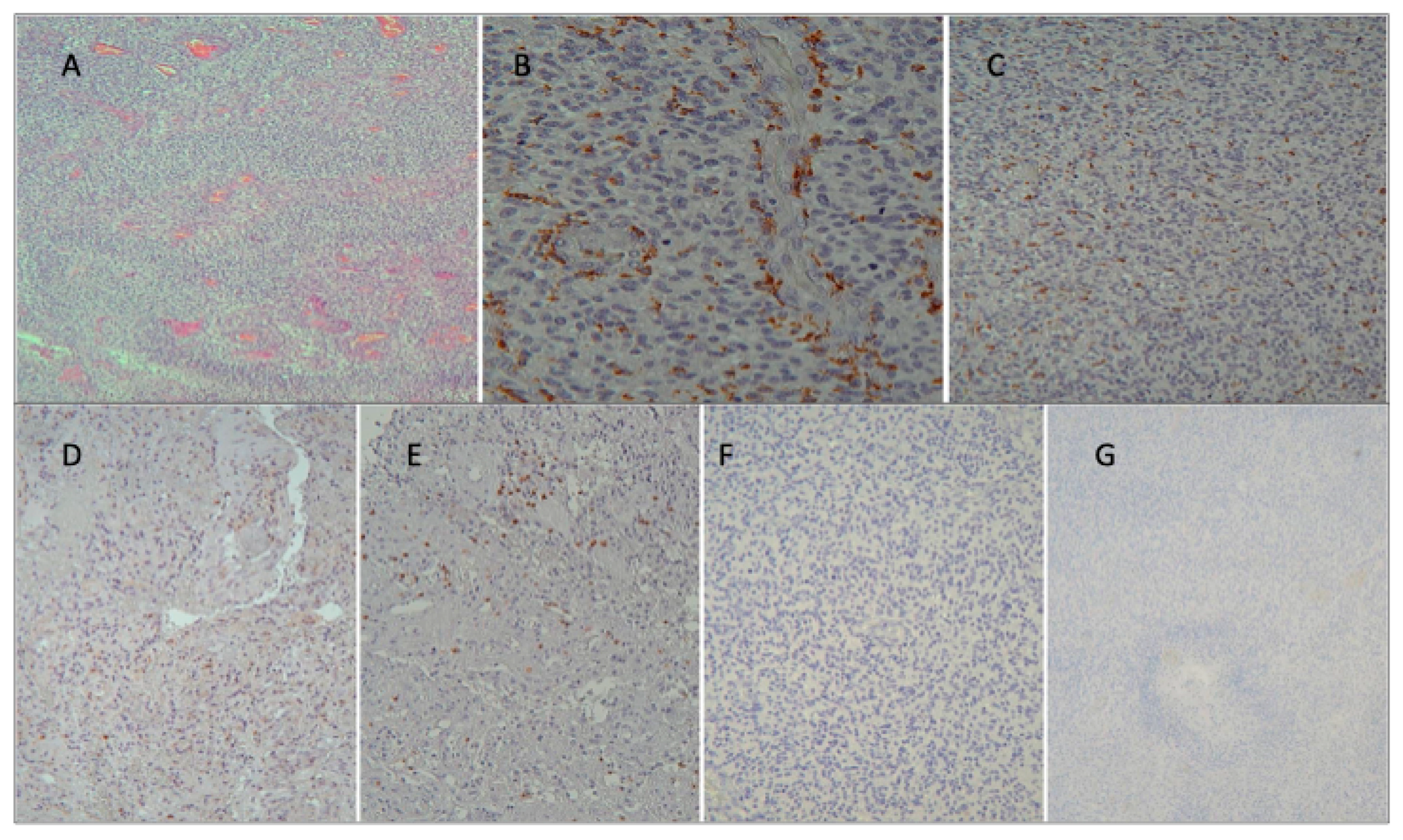 Cancers 16 03859 g003