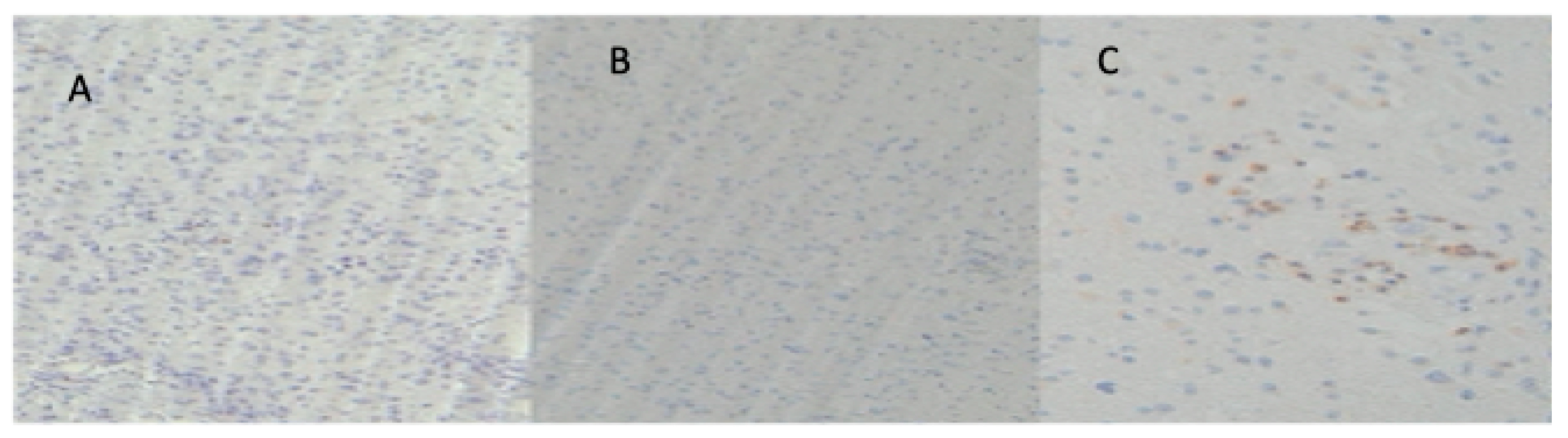 Cancers 16 03859 g004