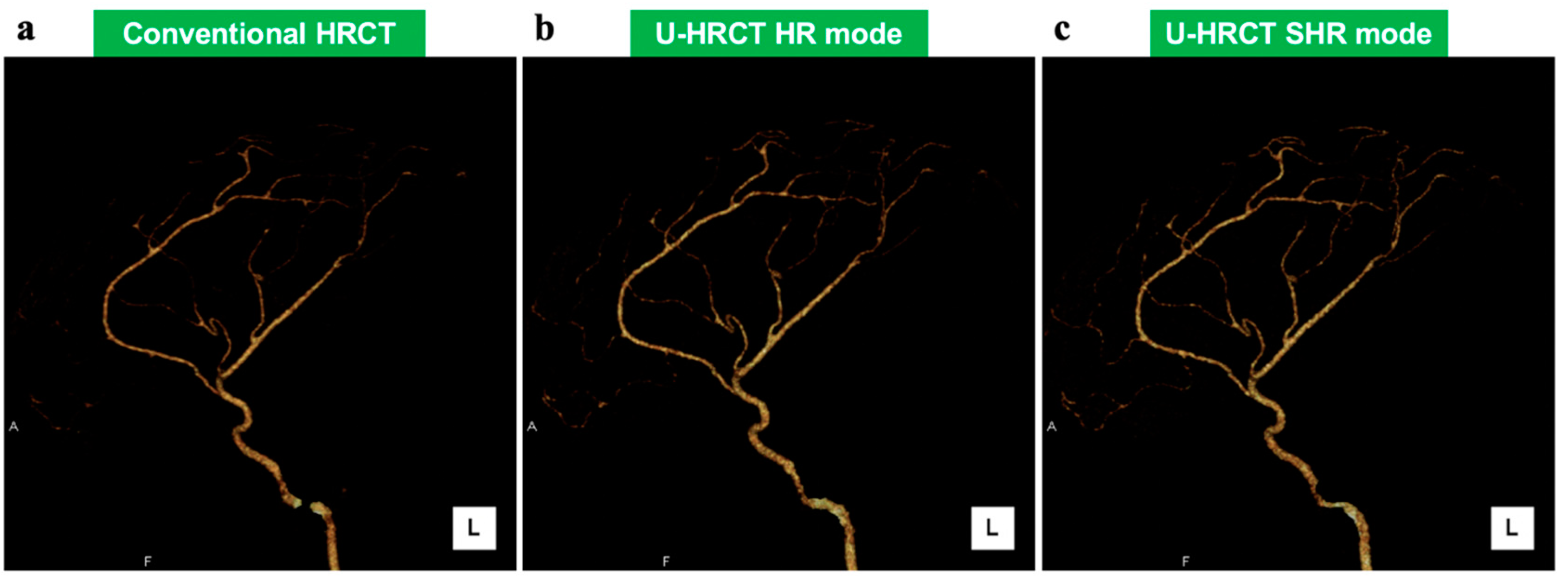 Cancers 16 03866 g002