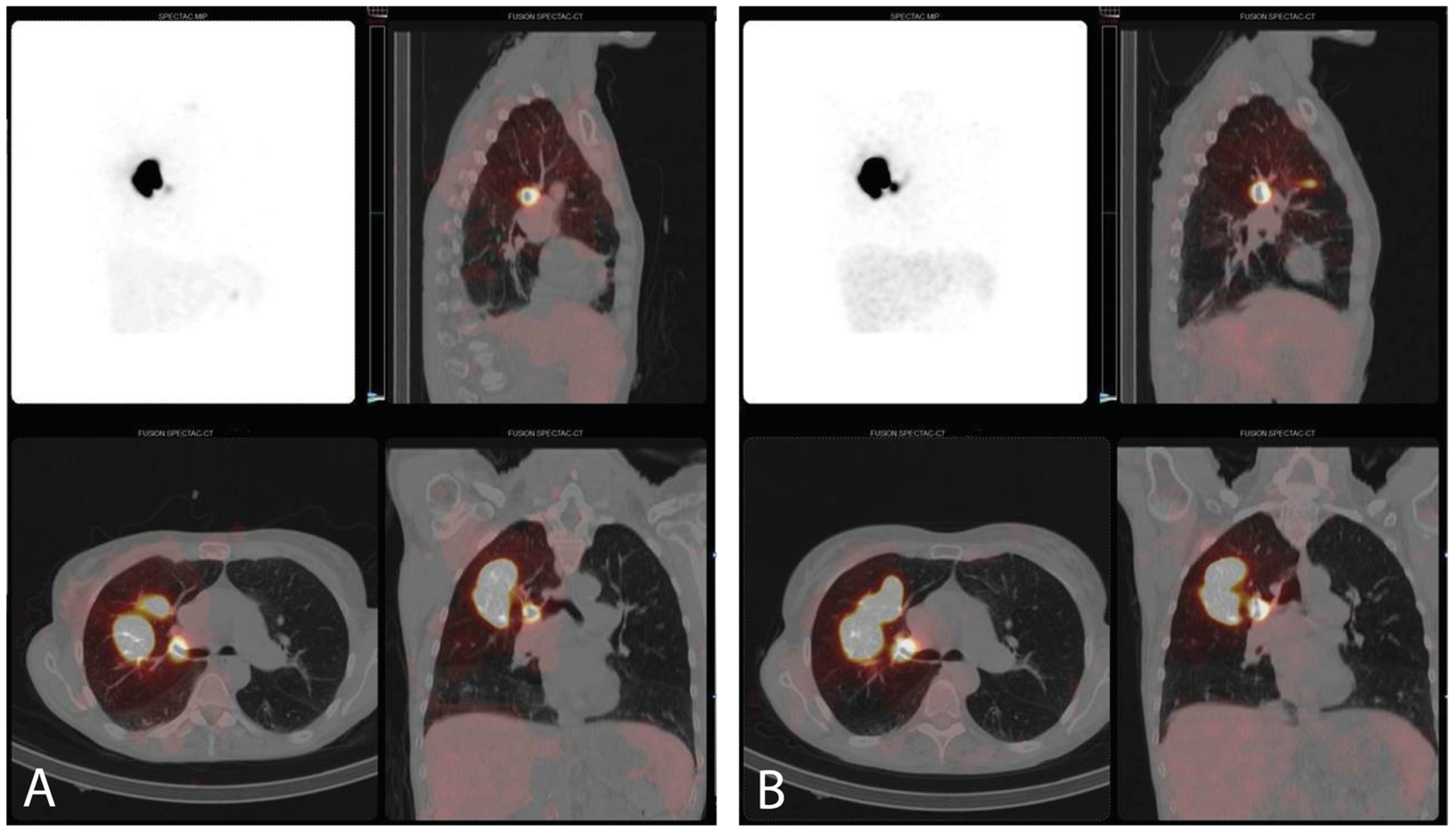 Cancers 16 03868 g003