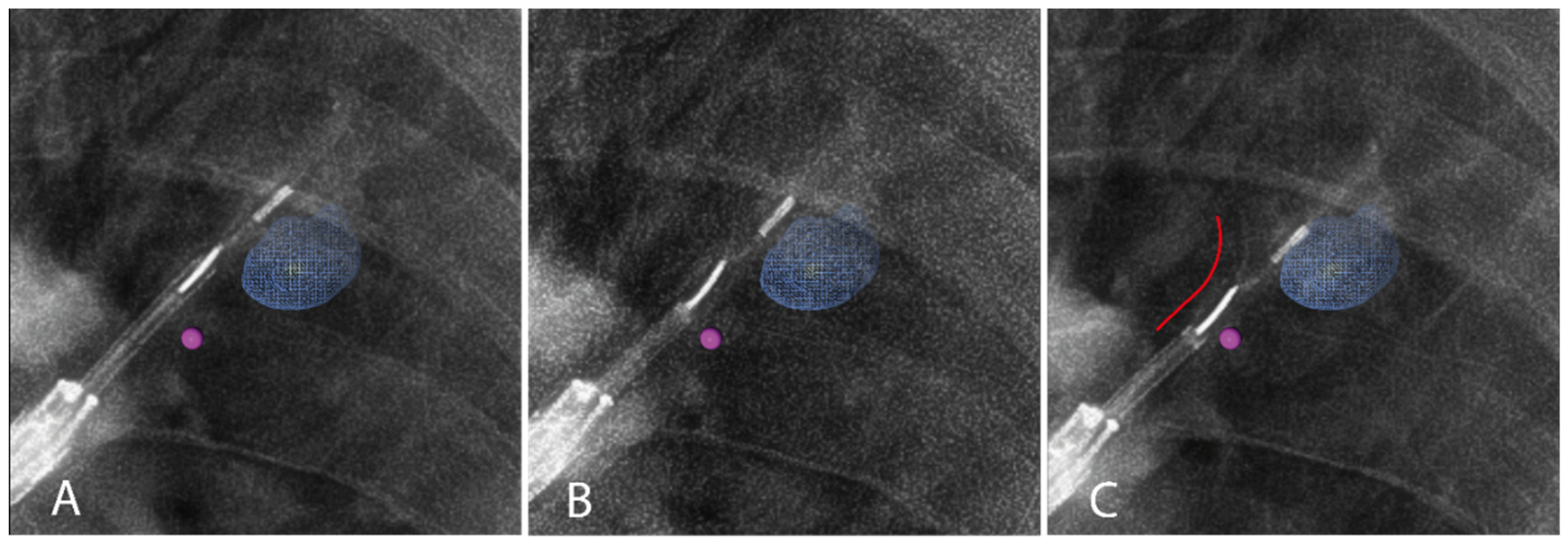 Cancers 16 03868 g0a1