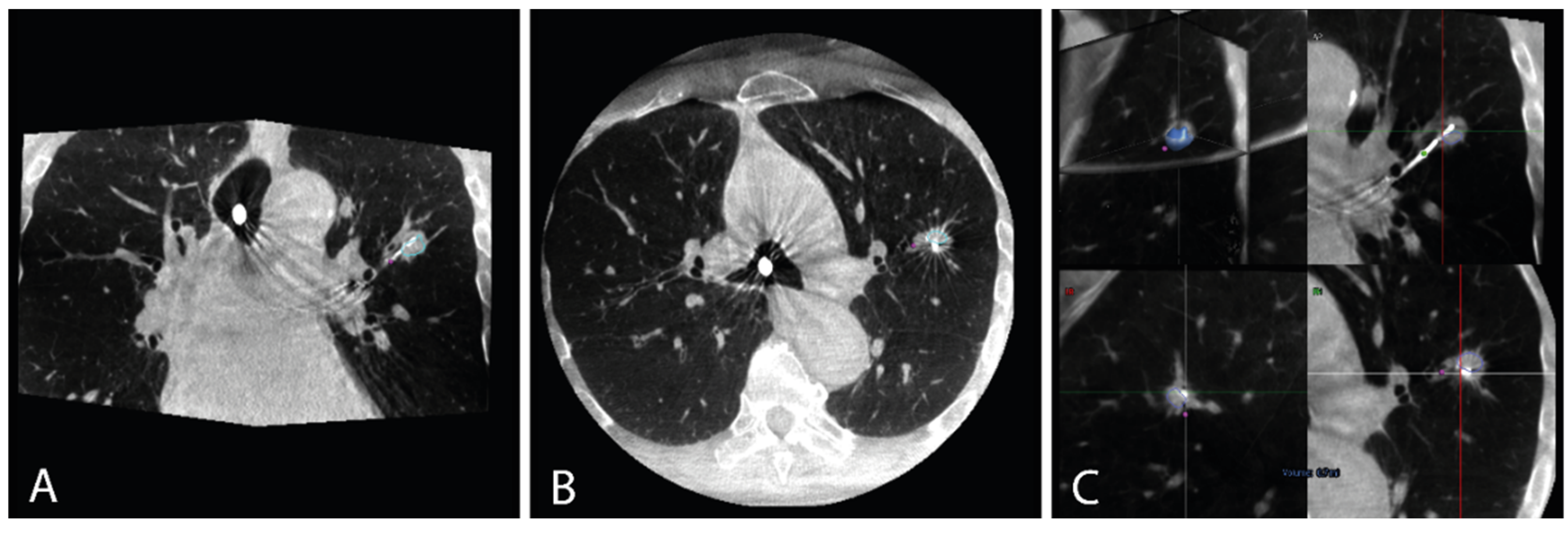 Cancers 16 03868 g0a2