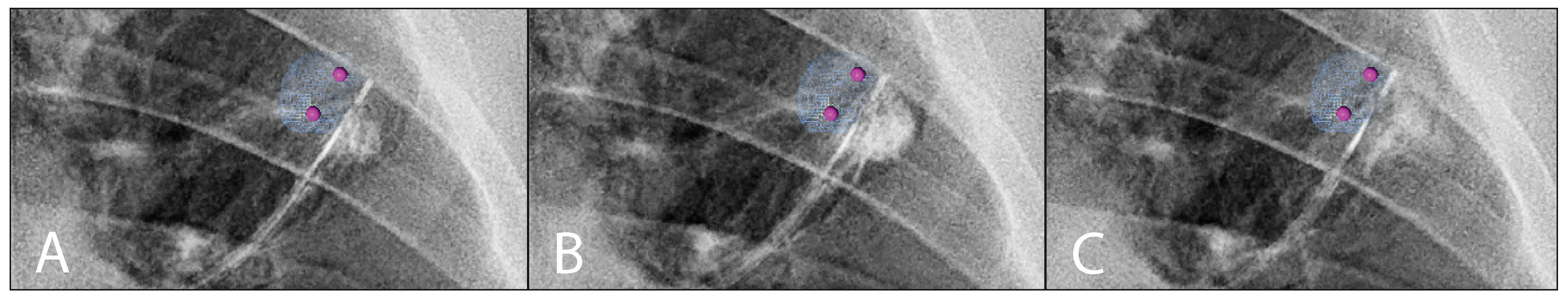 Cancers 16 03868 g0a3