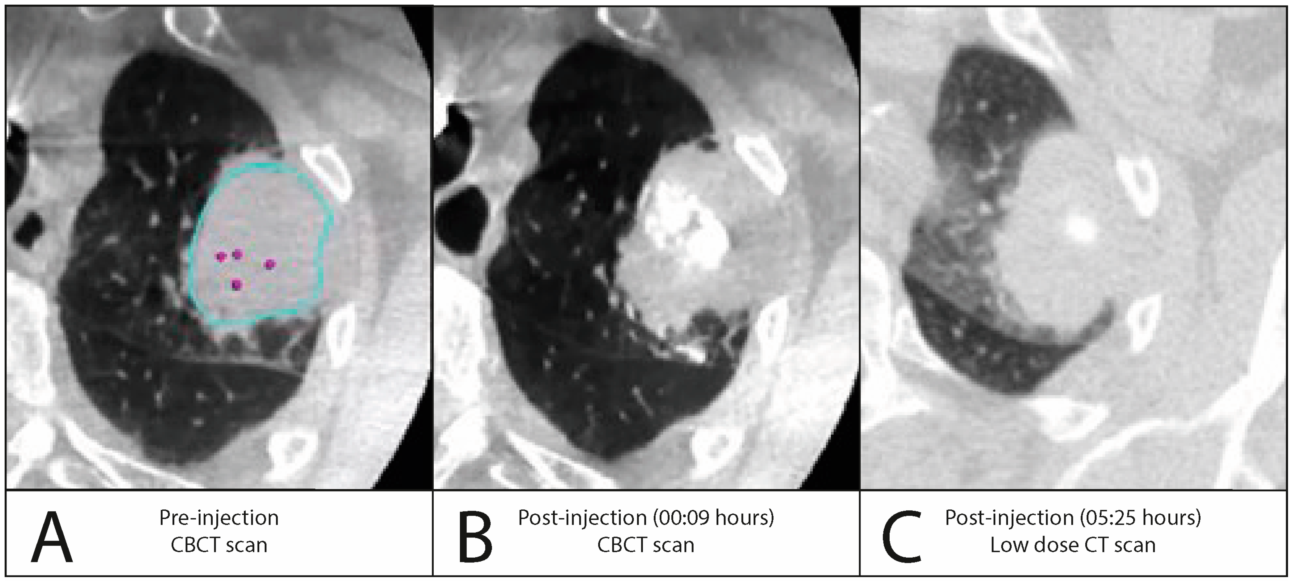 Cancers 16 03868 g0a4