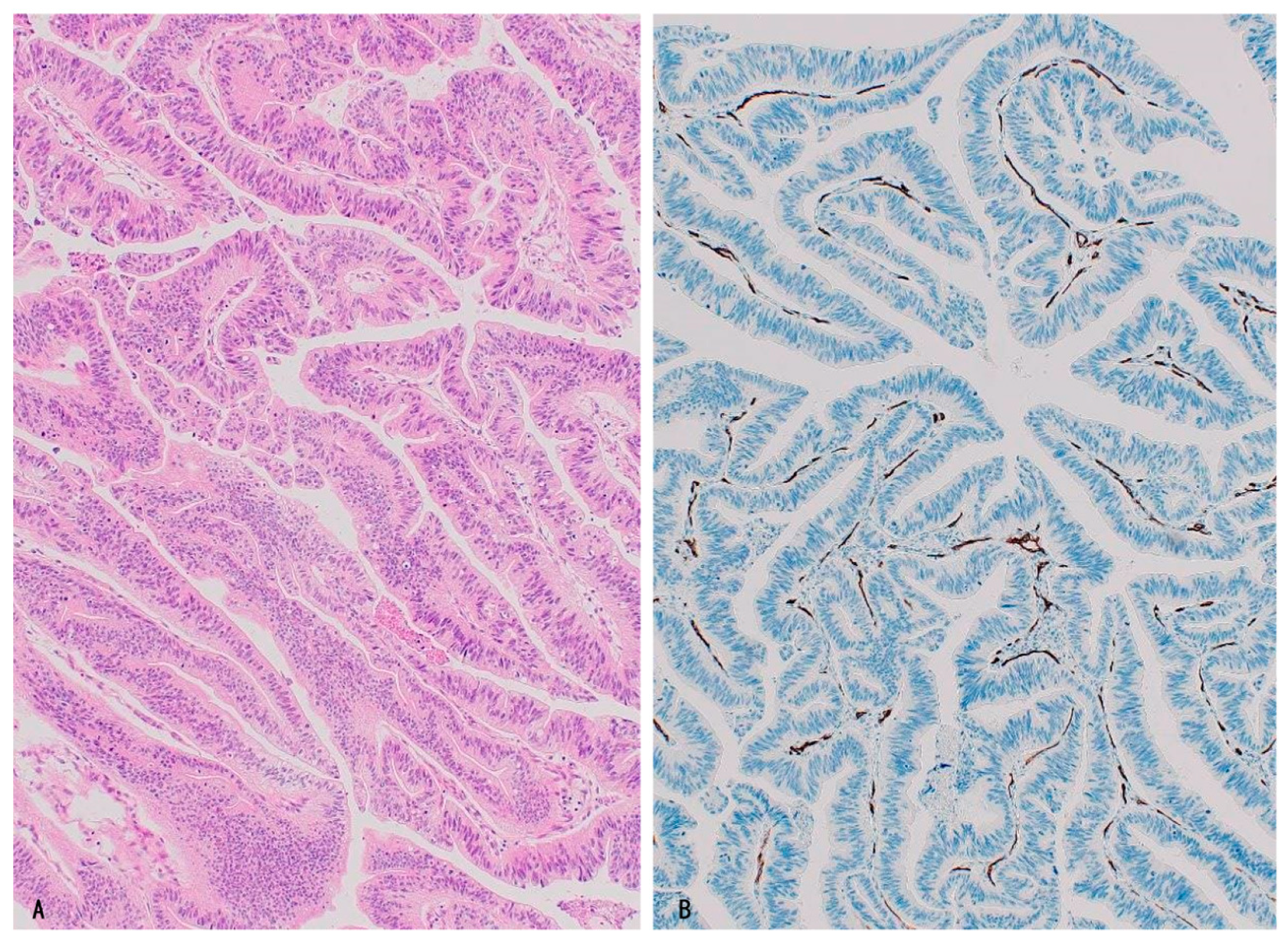 Cancers 16 03869 g004